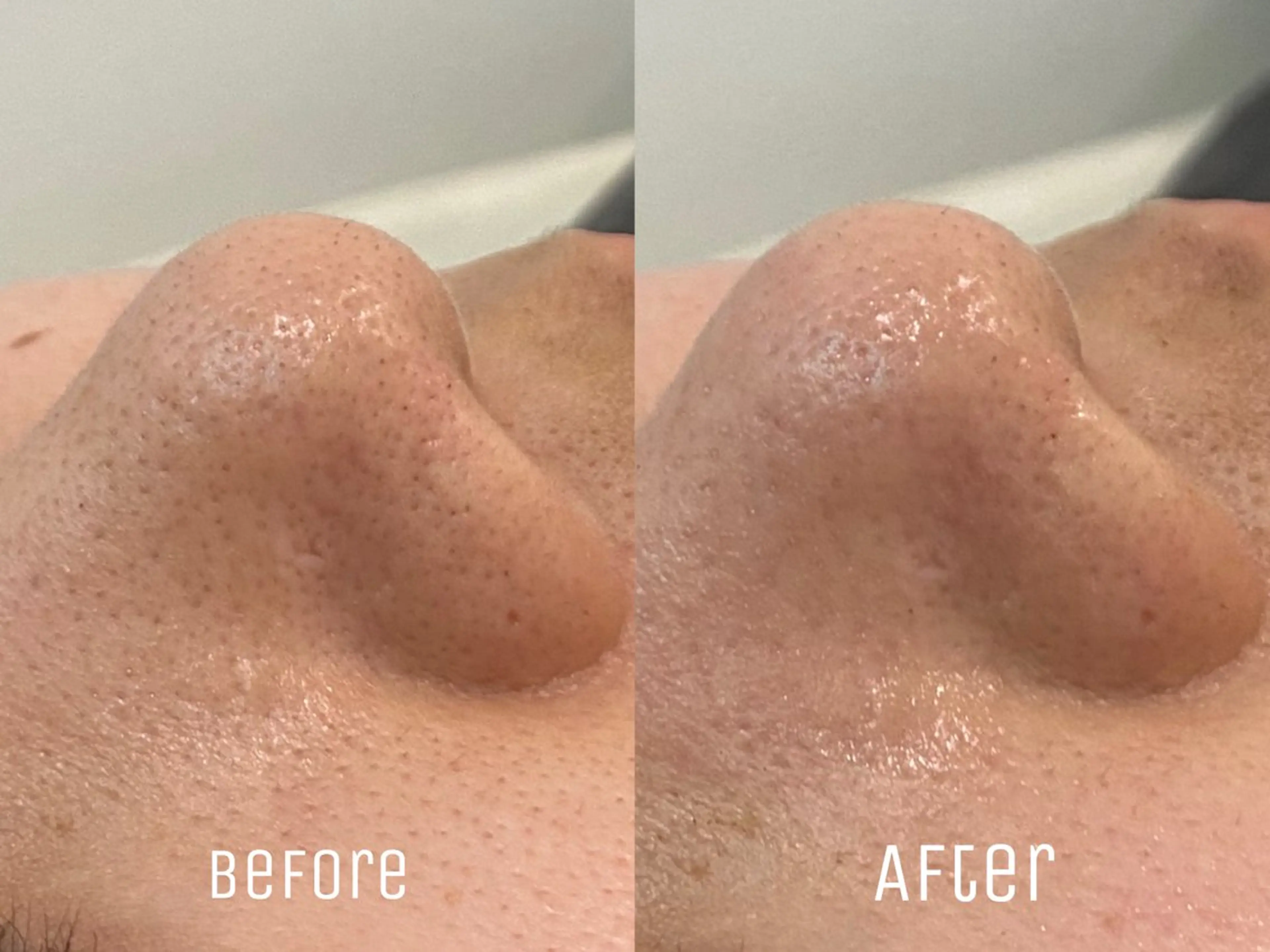 エステ ニキビ・毛穴・肌荒れ &me 西宮北口店のその他イメージ