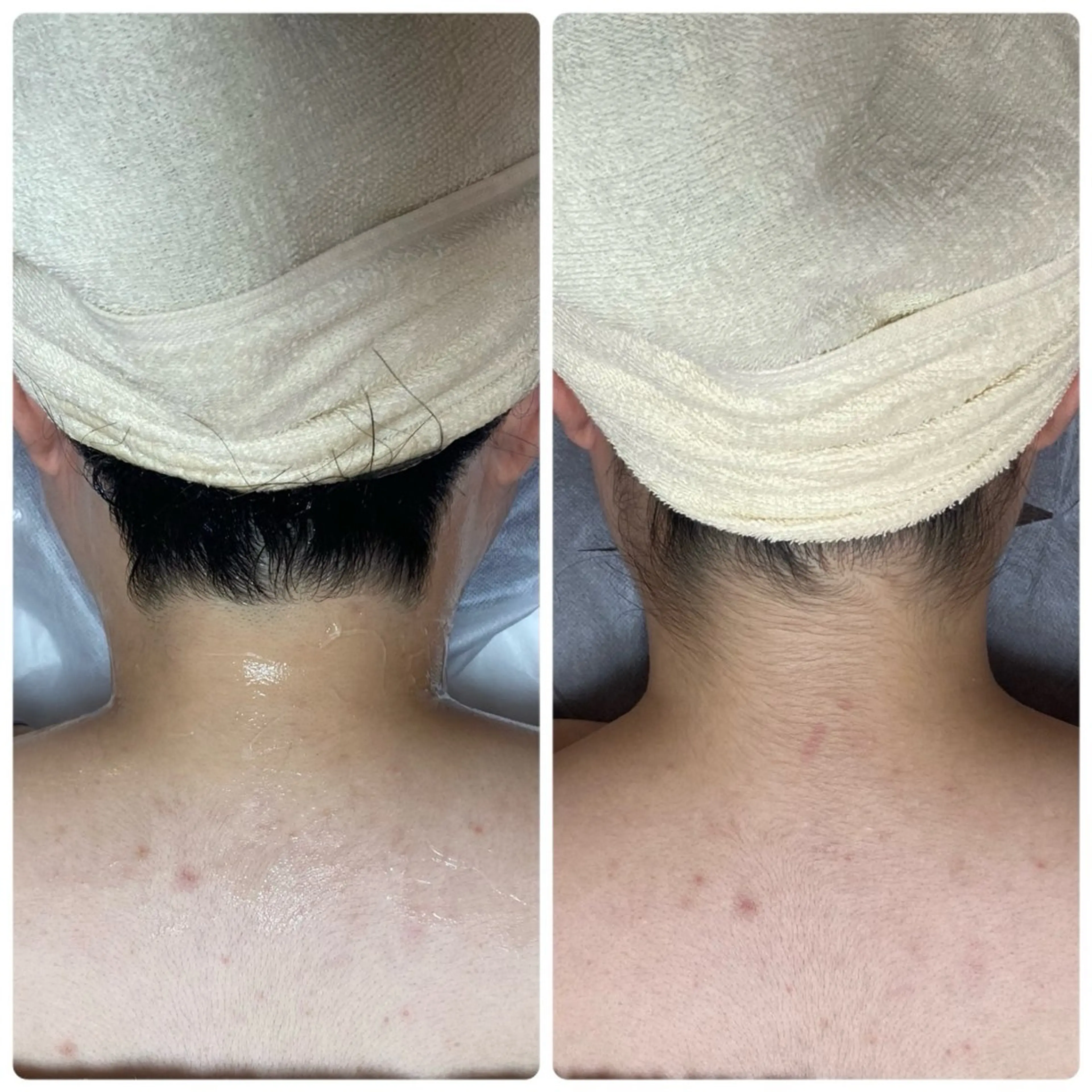 エステ 脱毛サロン エクボスタッフのエステ・リラクイメージ