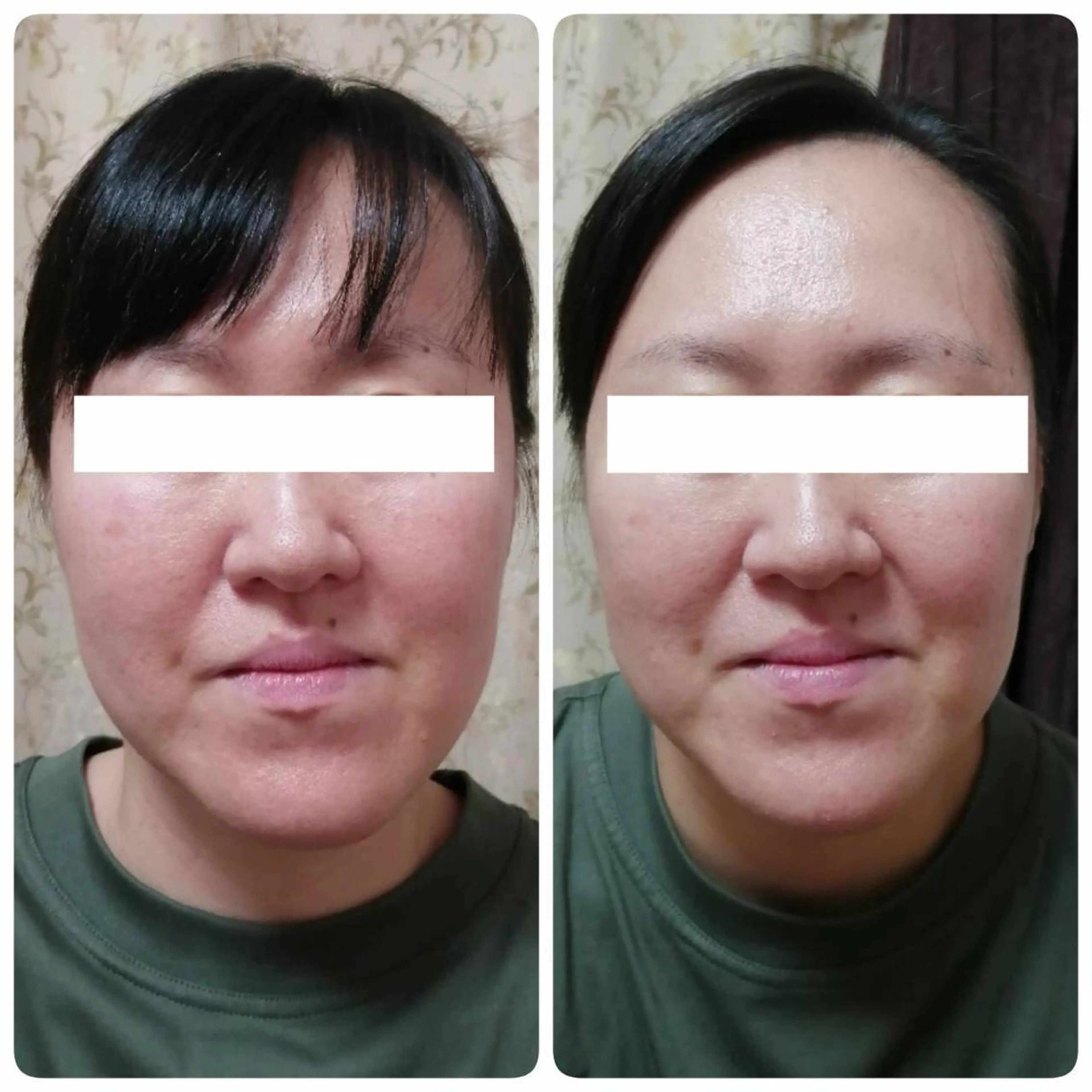 未病ケアサロン　EMINY所属・未病ケアサロン EMINY☺︎勝俣のエステ・リラクイメージ