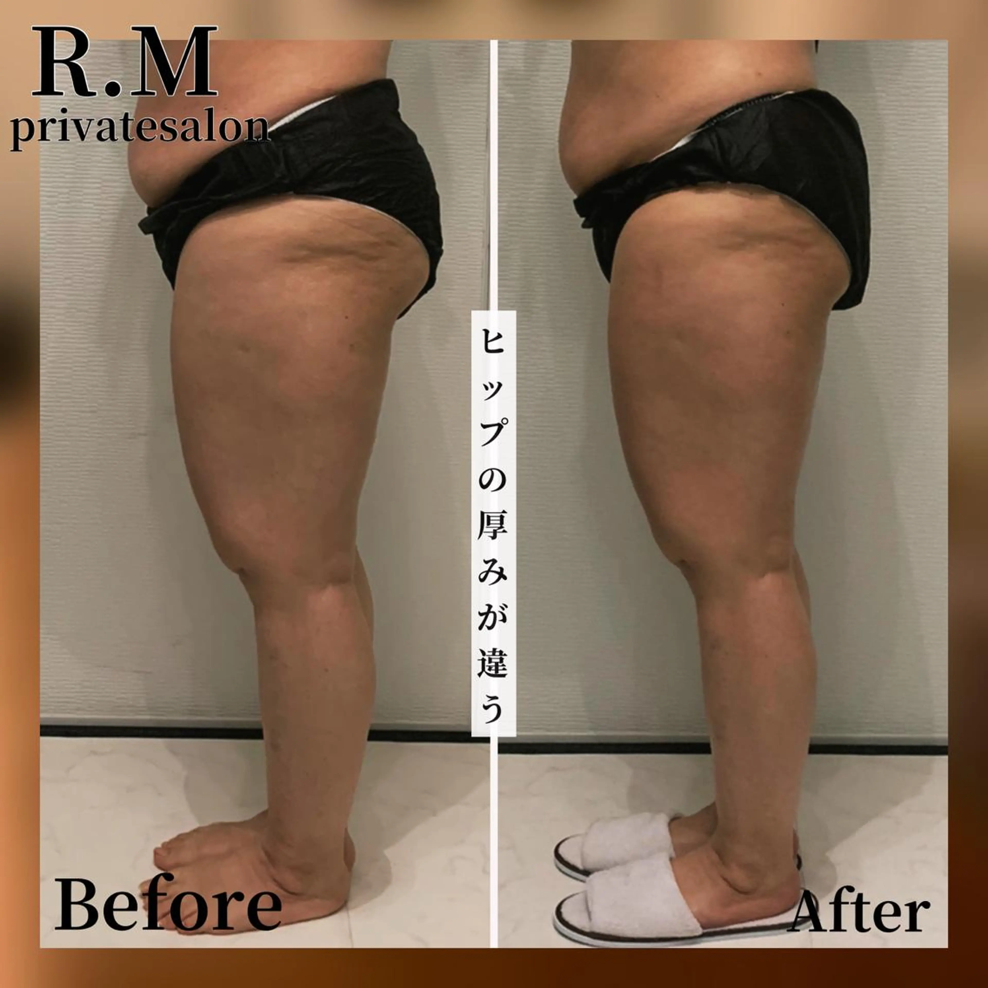 R.M所属・プライベートサロン R.Mのエステ・リラクイメージ