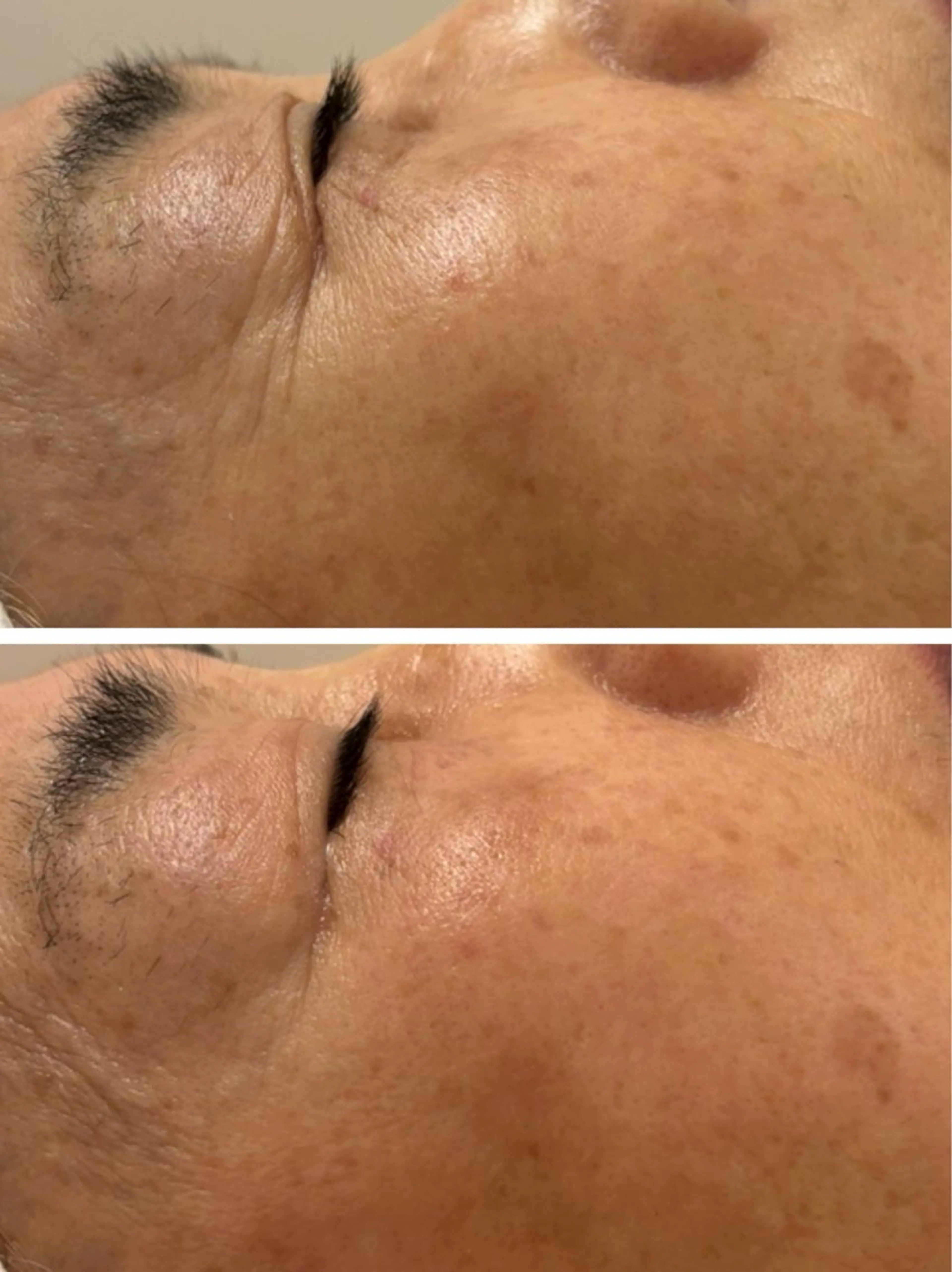 大阪大東市 / 体質・肌質改善サロン アンシャンテ所属・体質・肌質改善サロン アンシャンテのエステ・リラクイメージ