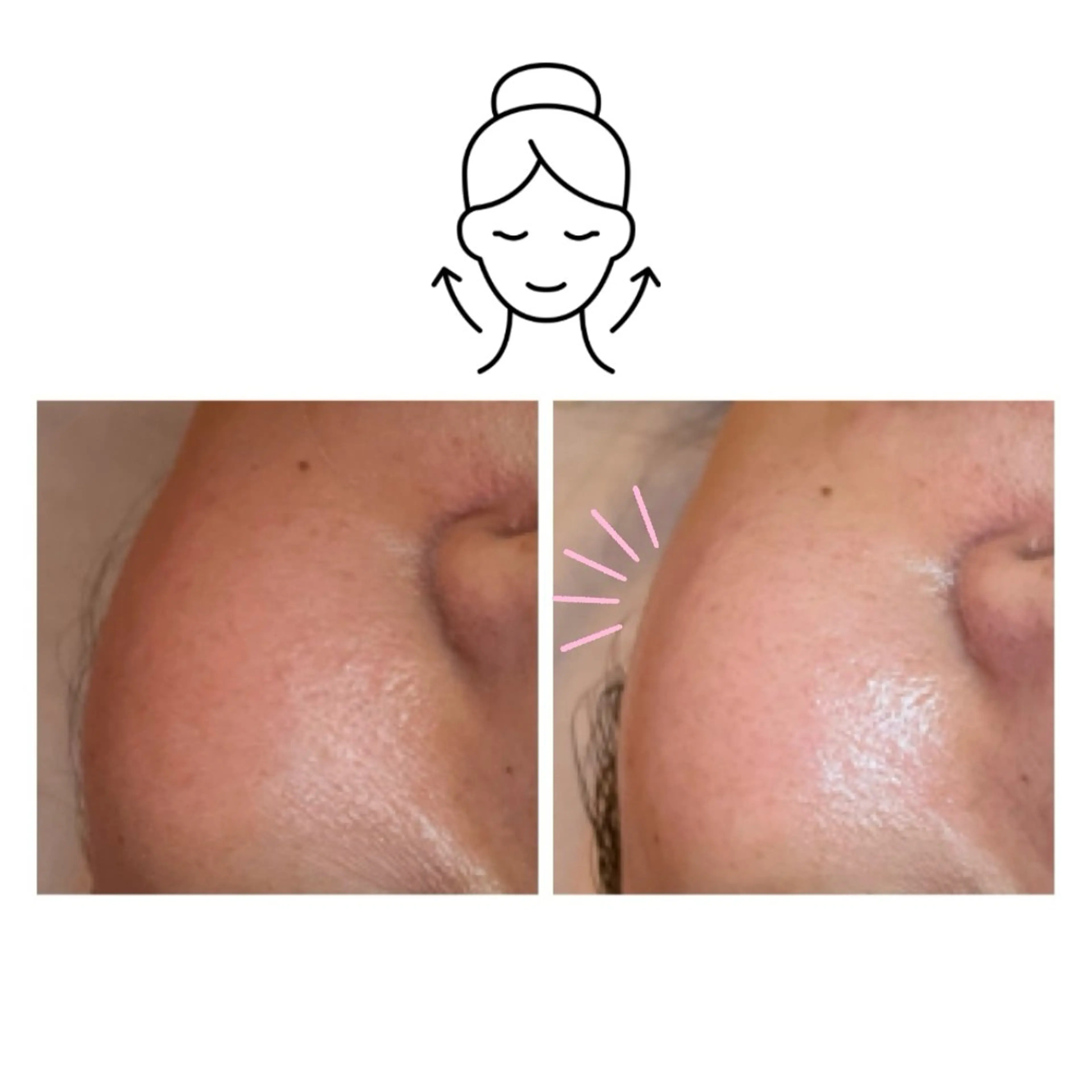 エステ ニキビ/敏感肌/乾燥 Lilyauraのエステ・リラクイメージ