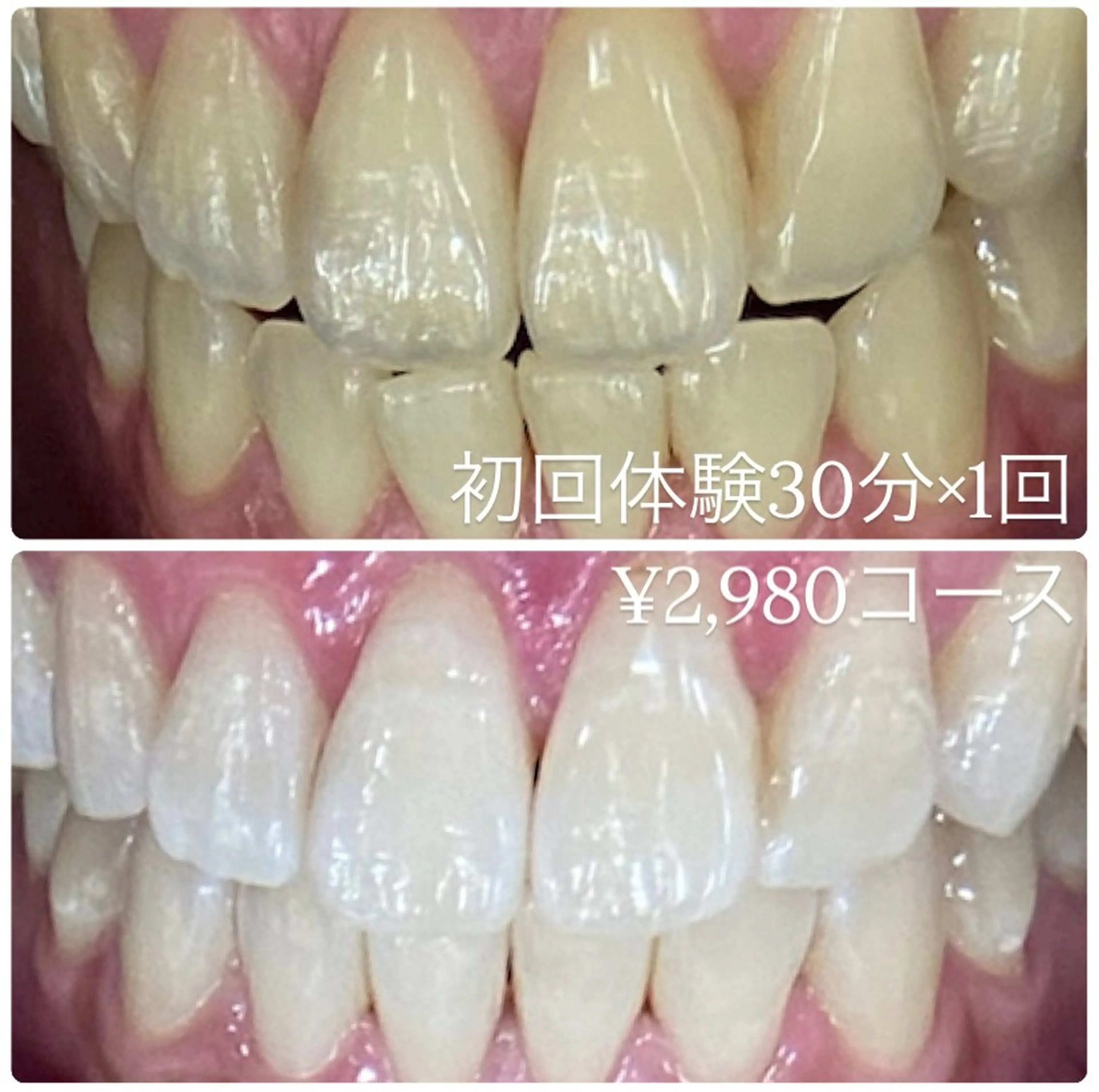 PLATINUM Beauty 横浜店所属・ホワイトニングルーム 横浜店のその他イメージ