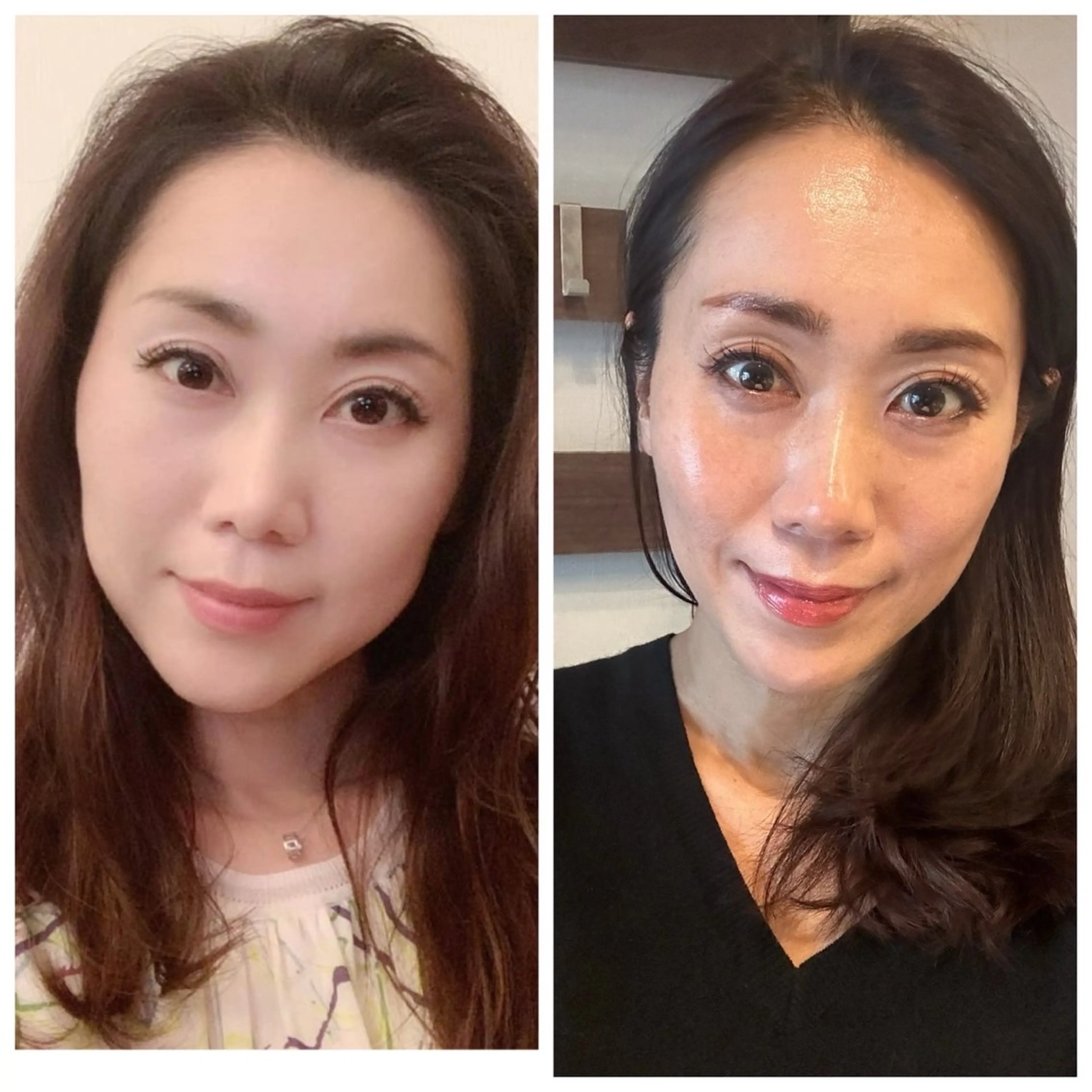 ダイヤモンド💎ピールプログラムの写真