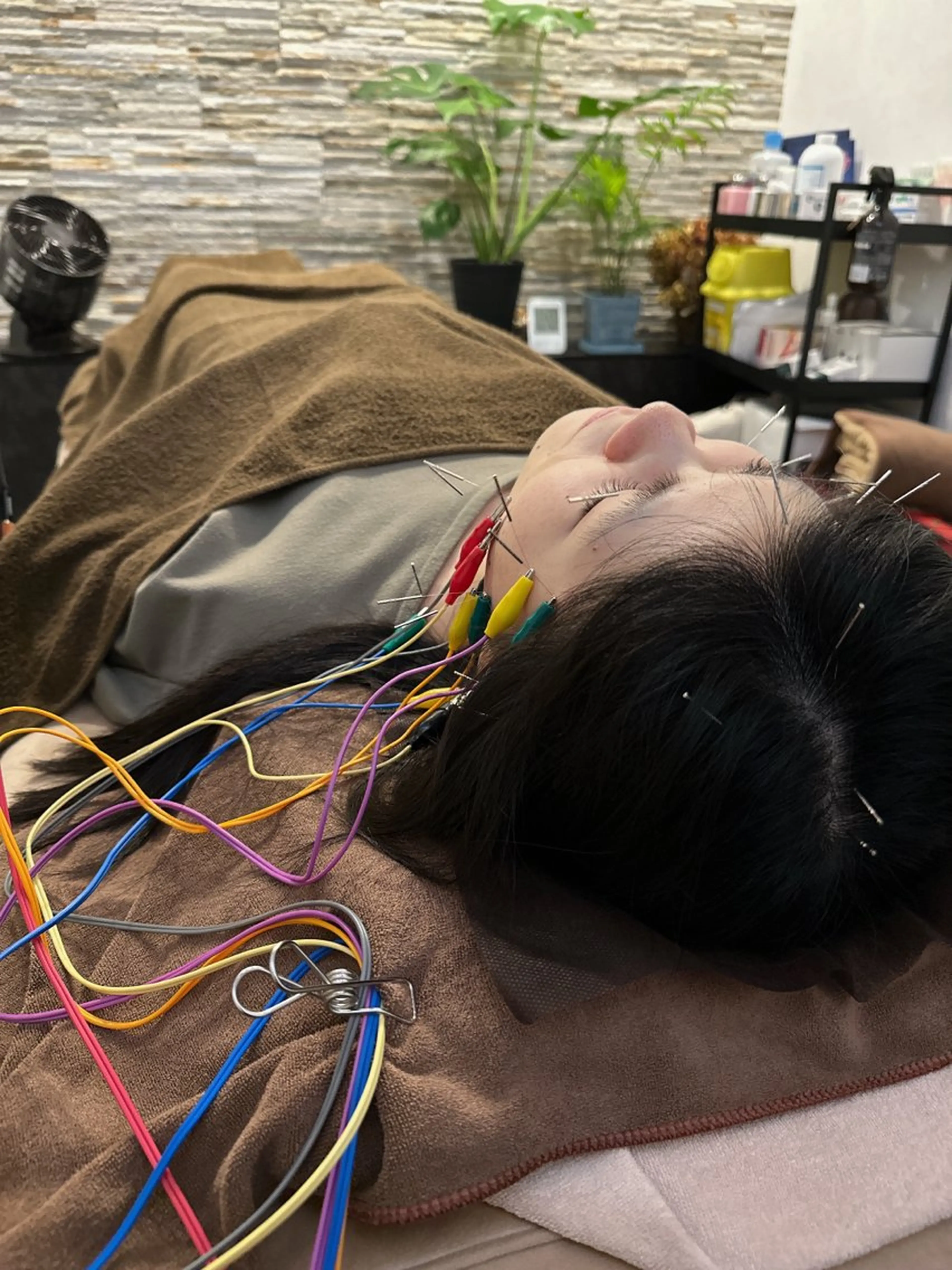 その他 美容鍼灸整体サロンBeauJu所属・小顔矯/美容鍼/鍼灸 BeauJuのその他イメージ