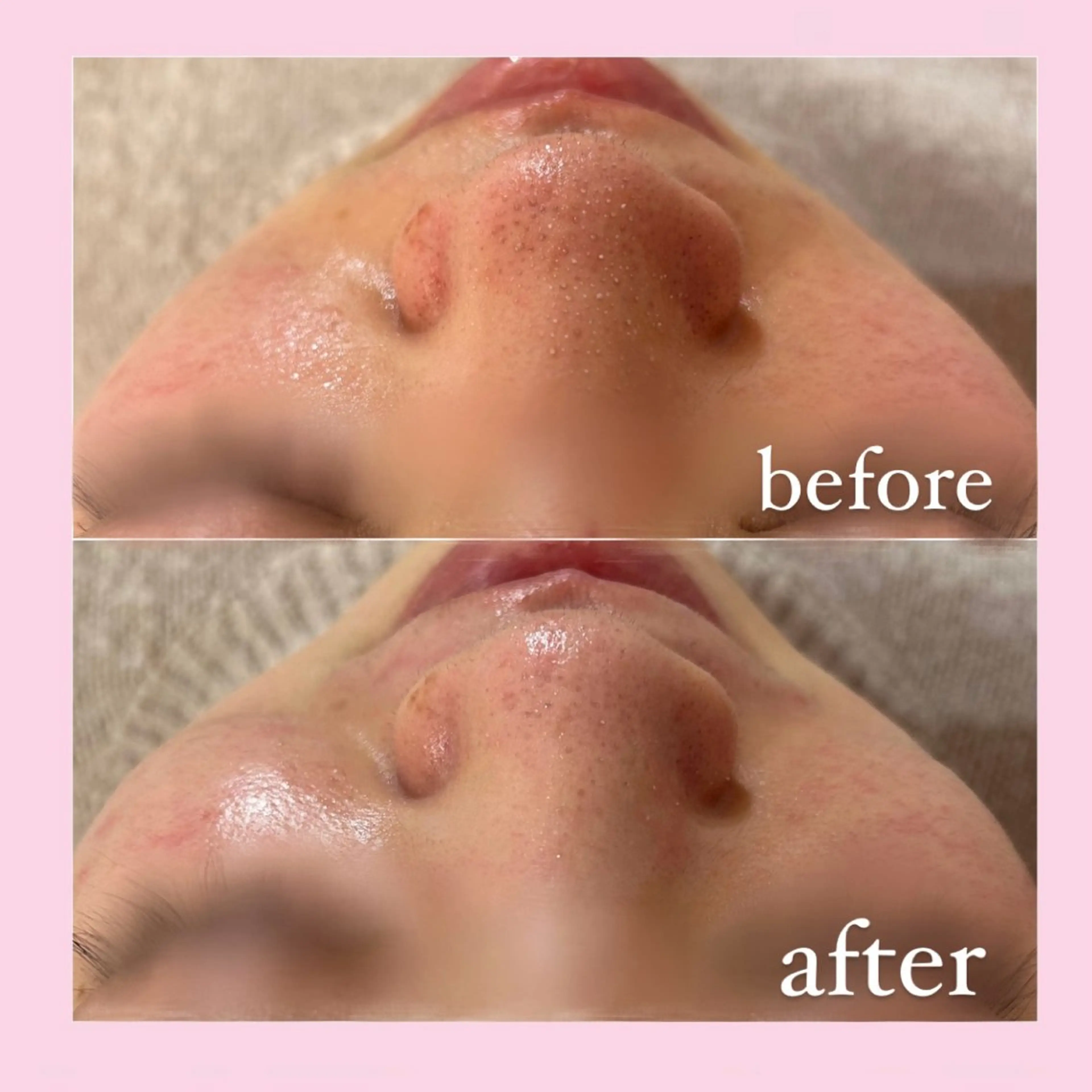 エステ 韓国肌管理専門店　White labo 宝塚店所属・有川 凜のエステ・リラクイメージ