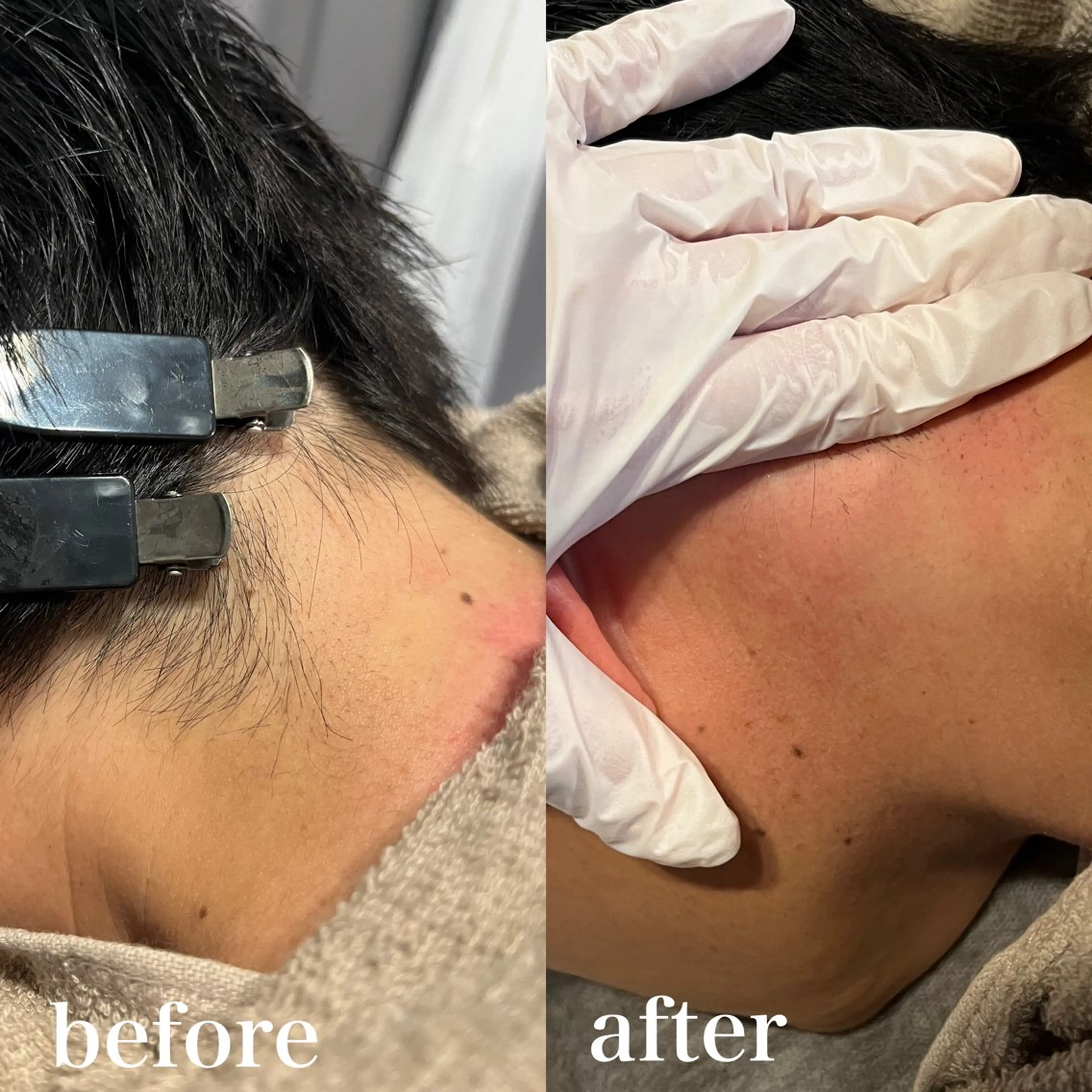 メンズ wax脱毛専門店 ハイラントのエステ・リラクイメージ