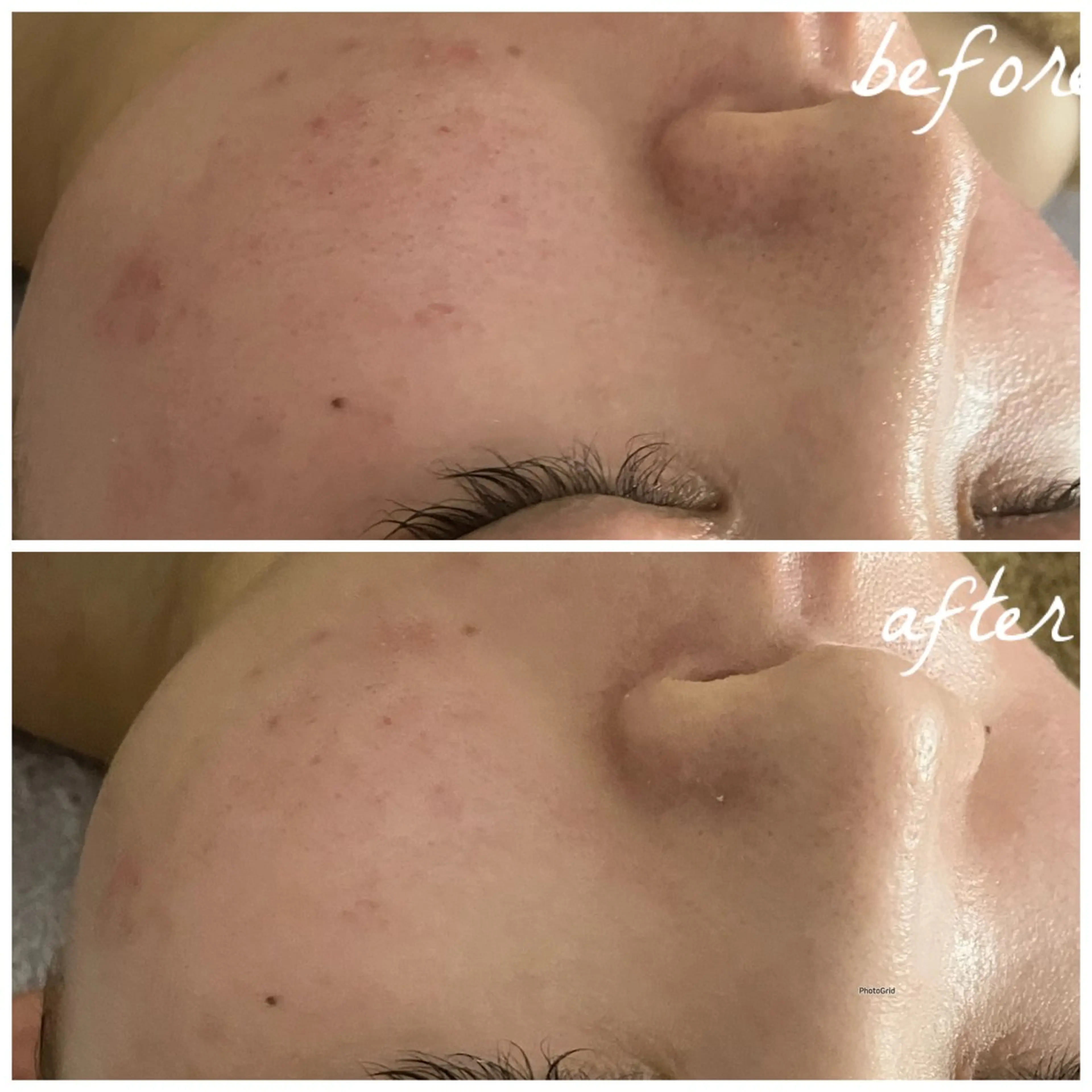 メンズ エステ メナード岐阜茜部 杉浦のエステ・リラクイメージ