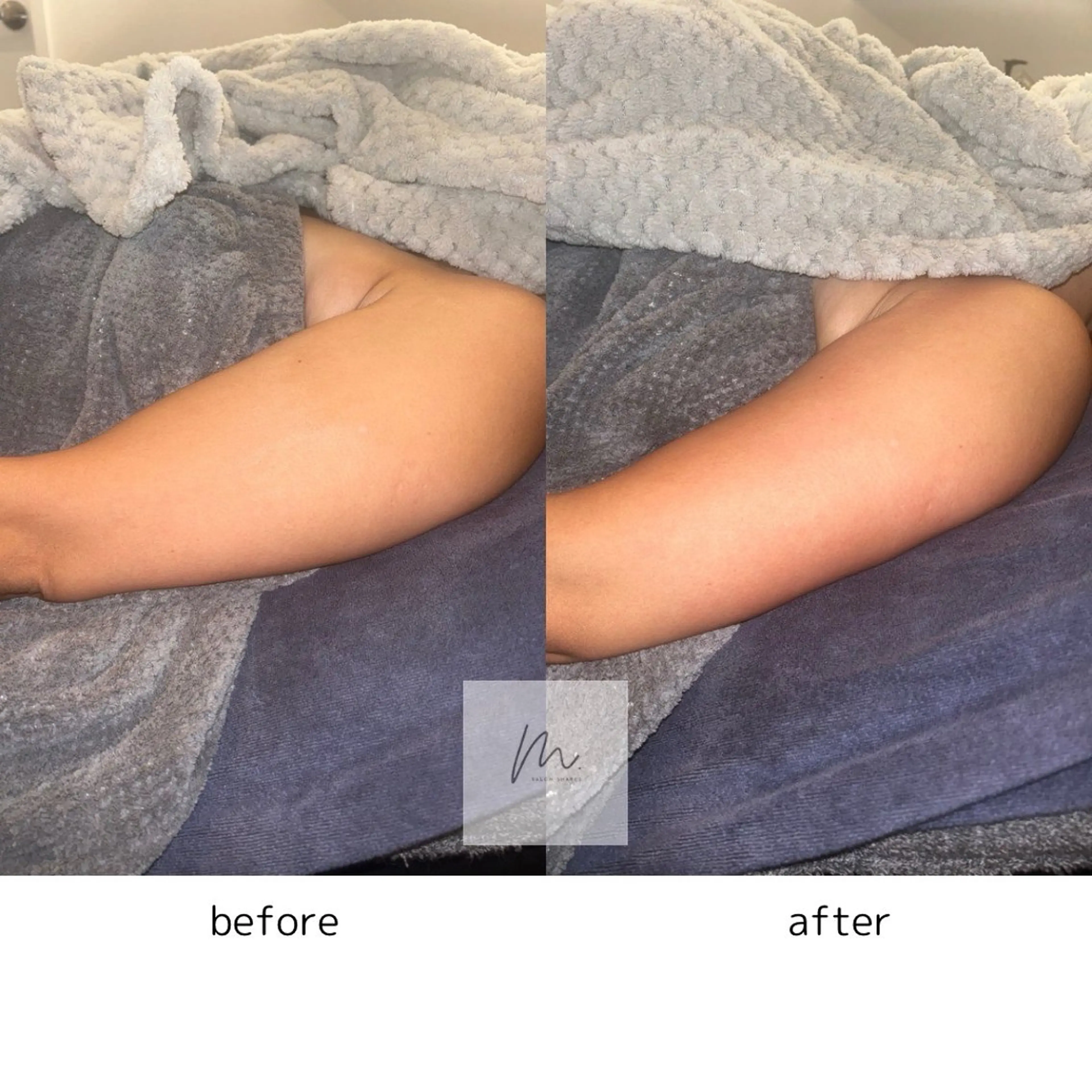 SHARES MADOKAのエステ・リラクイメージ