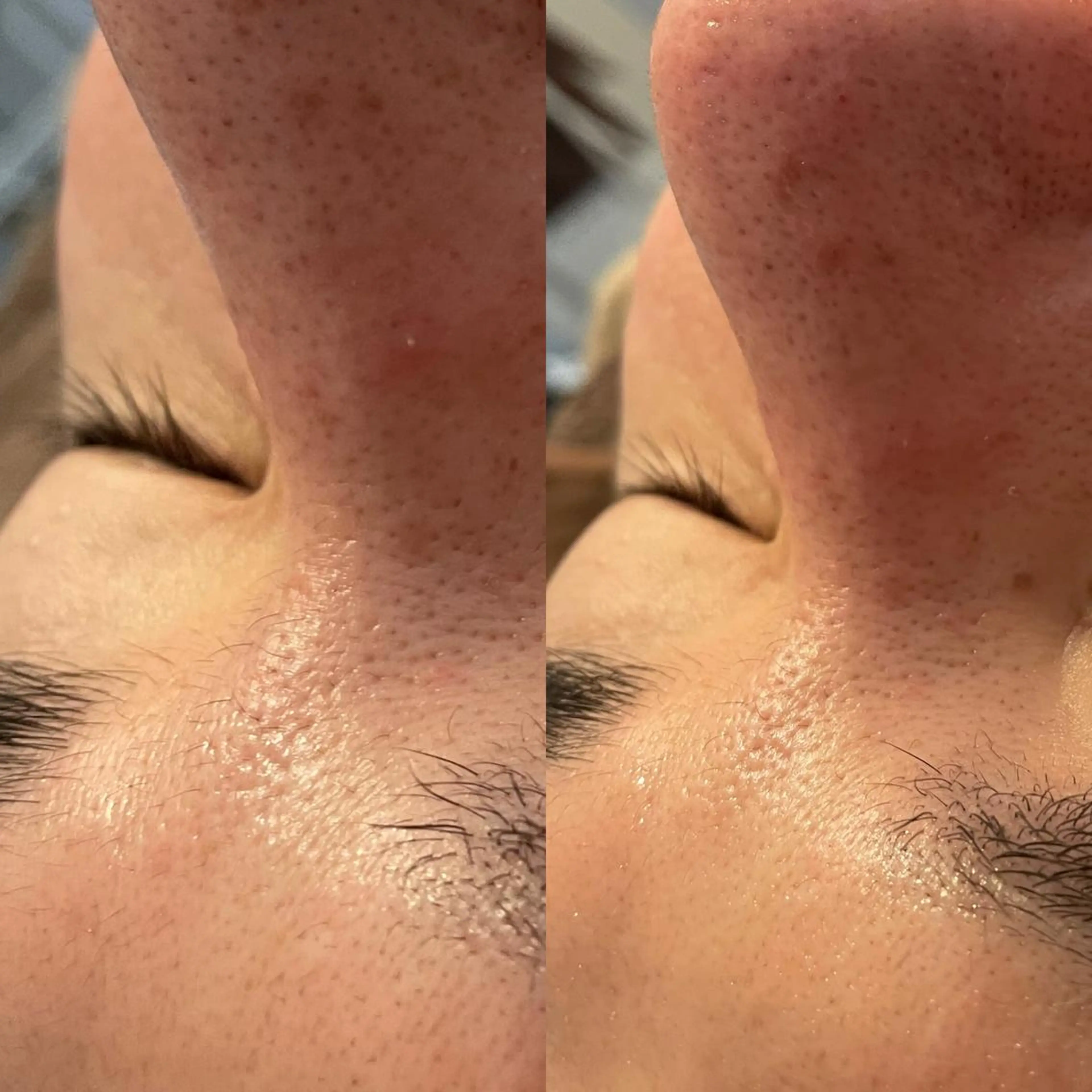 VERY VERY九条店所属・VERY VERY 九条店のエステ・リラクイメージ