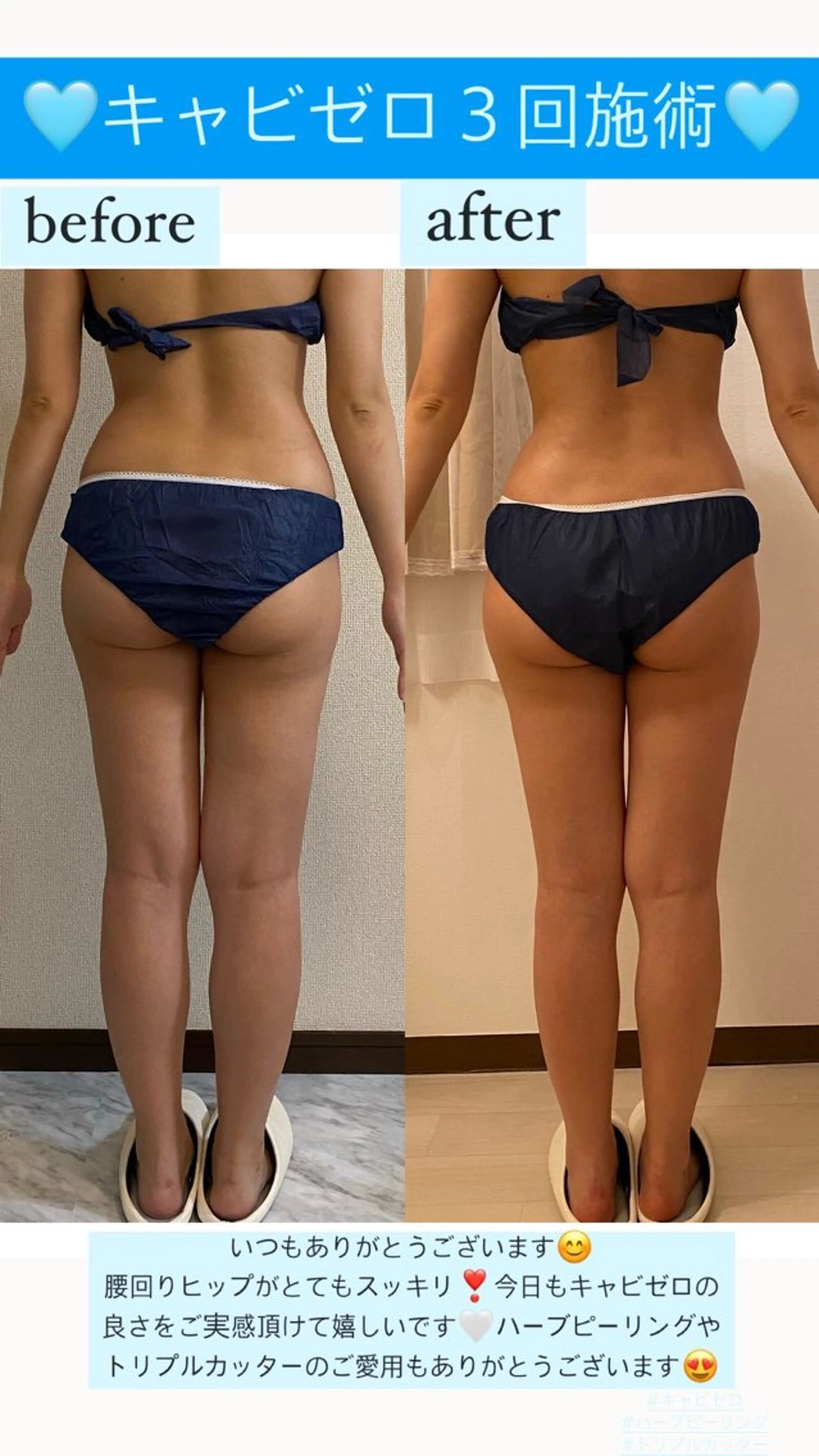 エステ リラク Salon de Lino 御器所のエステ・リラクイメージ