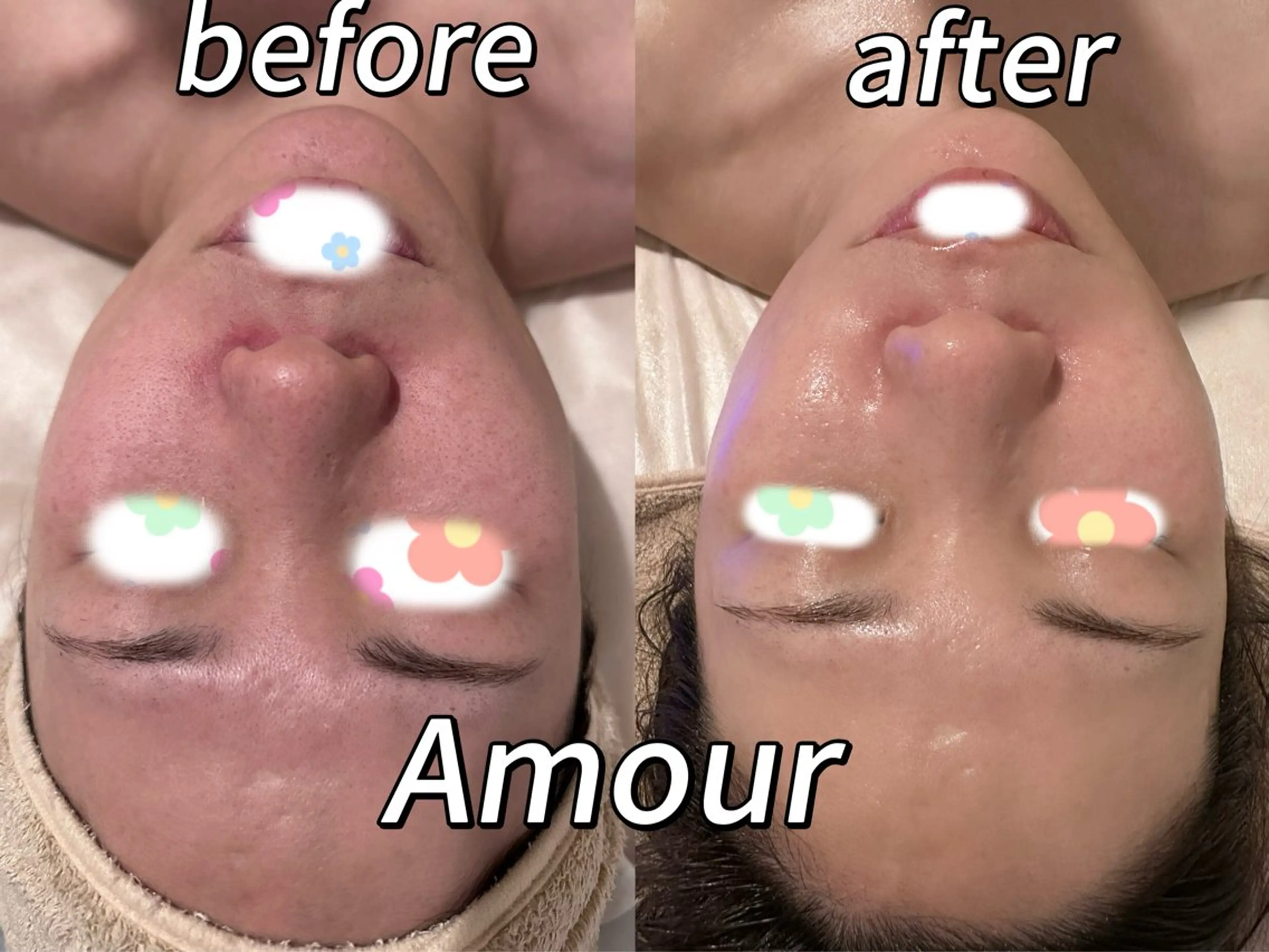 痩身・小顔・脱毛・ オイル&Amourのその他イメージ