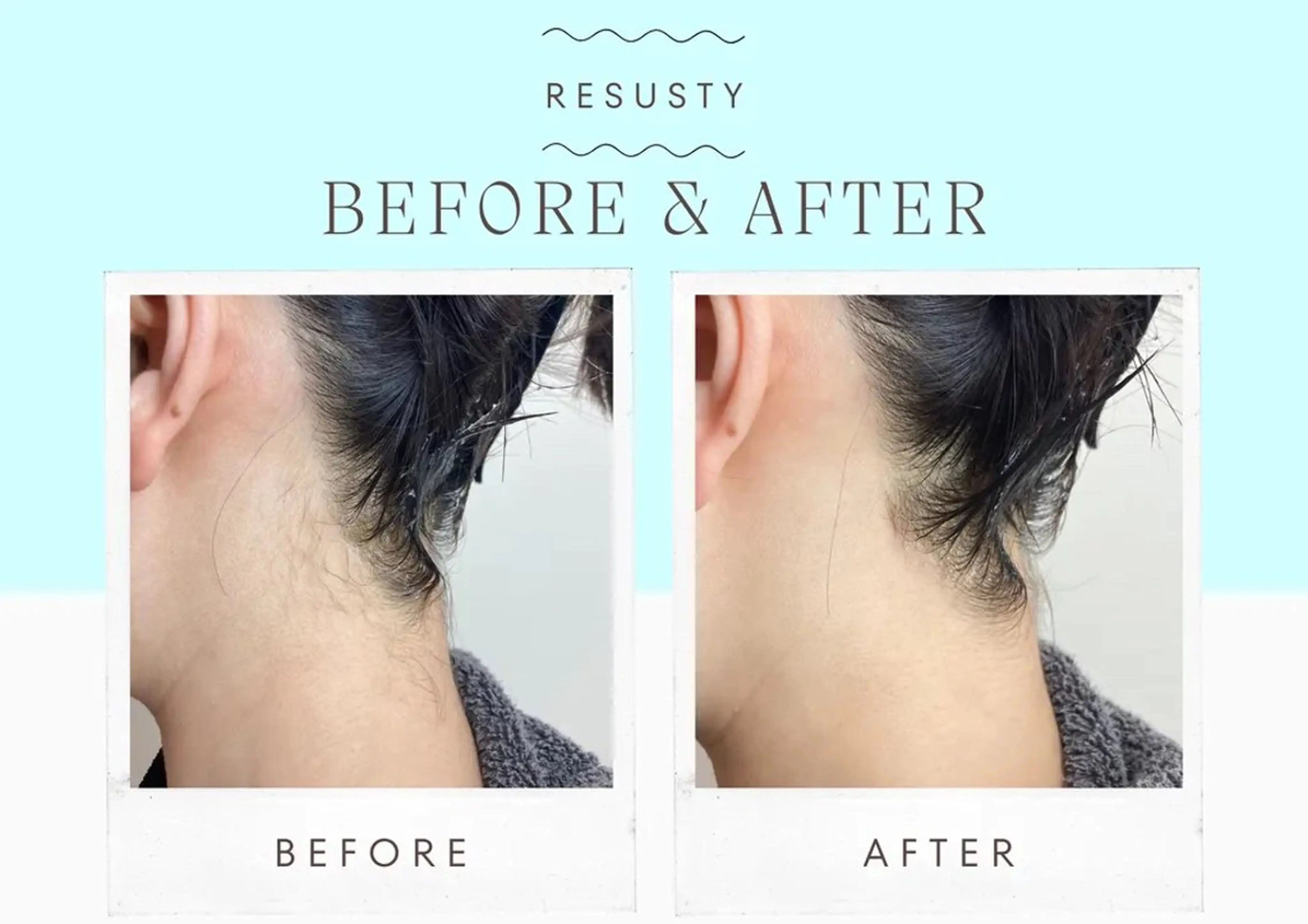 脱毛 MODE K's 白石彩夏のエステ・リラクイメージ