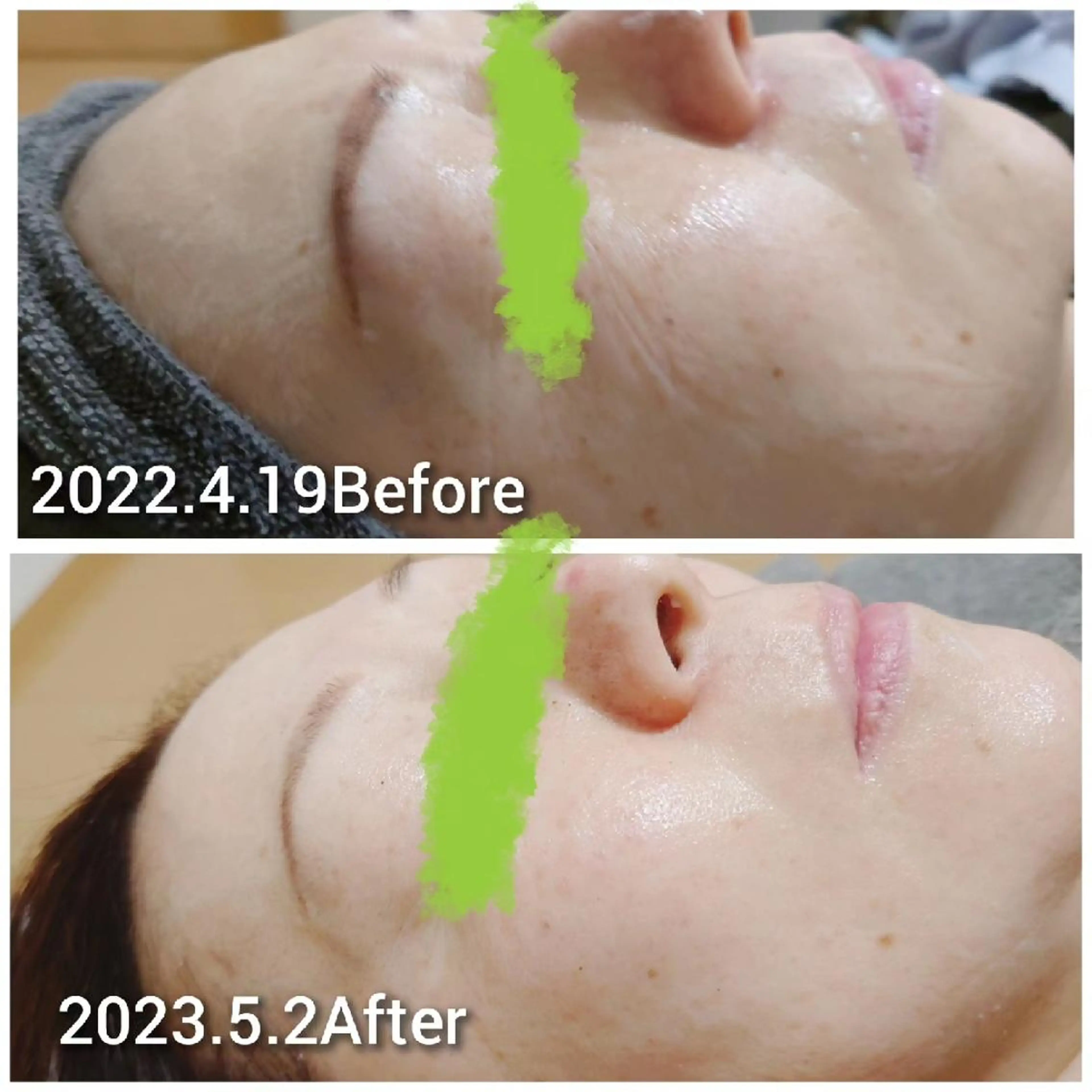 Beauty Salon Luana所属・Luanaまつパ脱毛 ハーブピーリング眉毛のマツエク・マツパデザイン