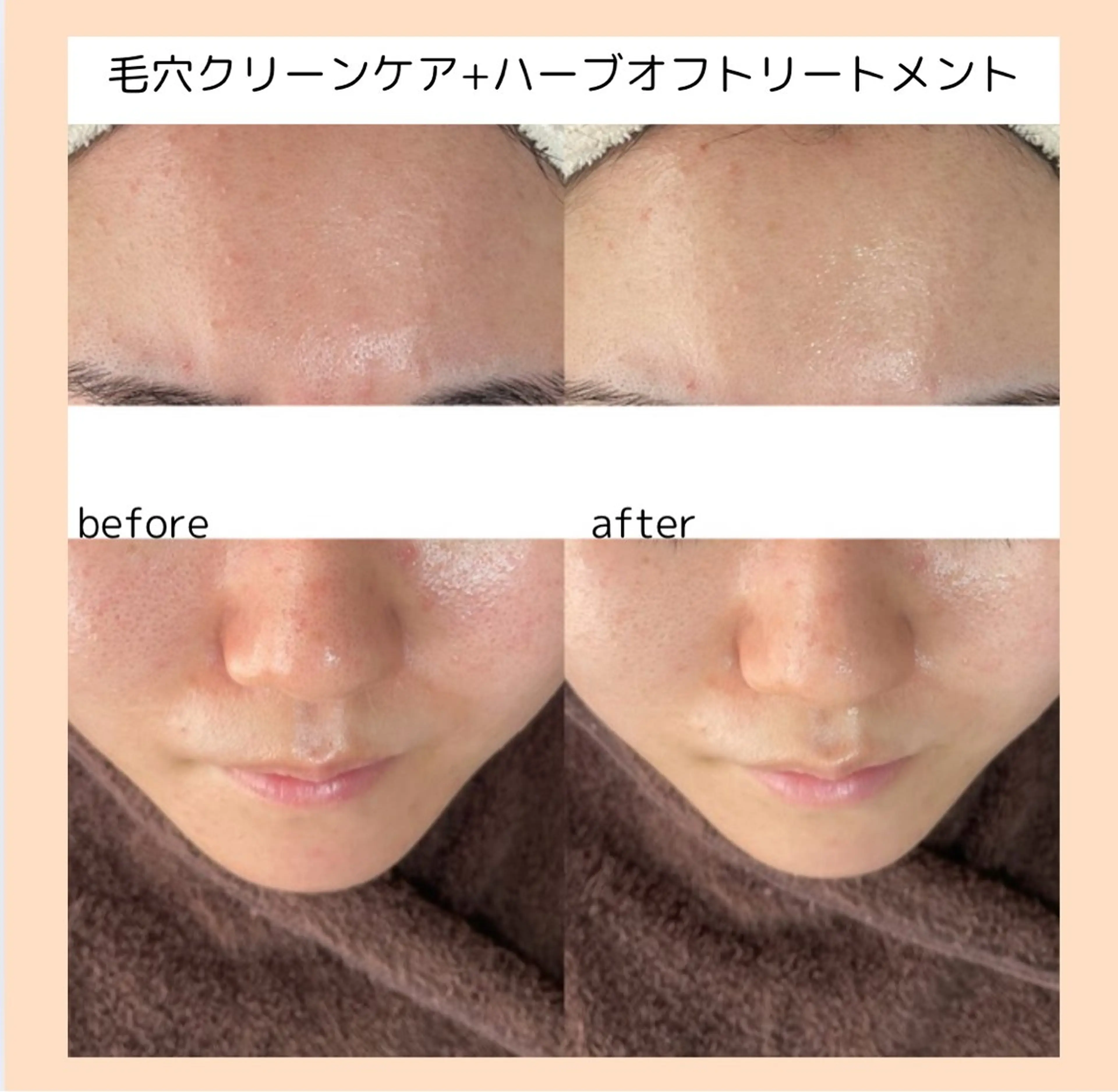 【three】毛穴/ 肌改善/小顔/耳ツボのエステ・リラクイメージ