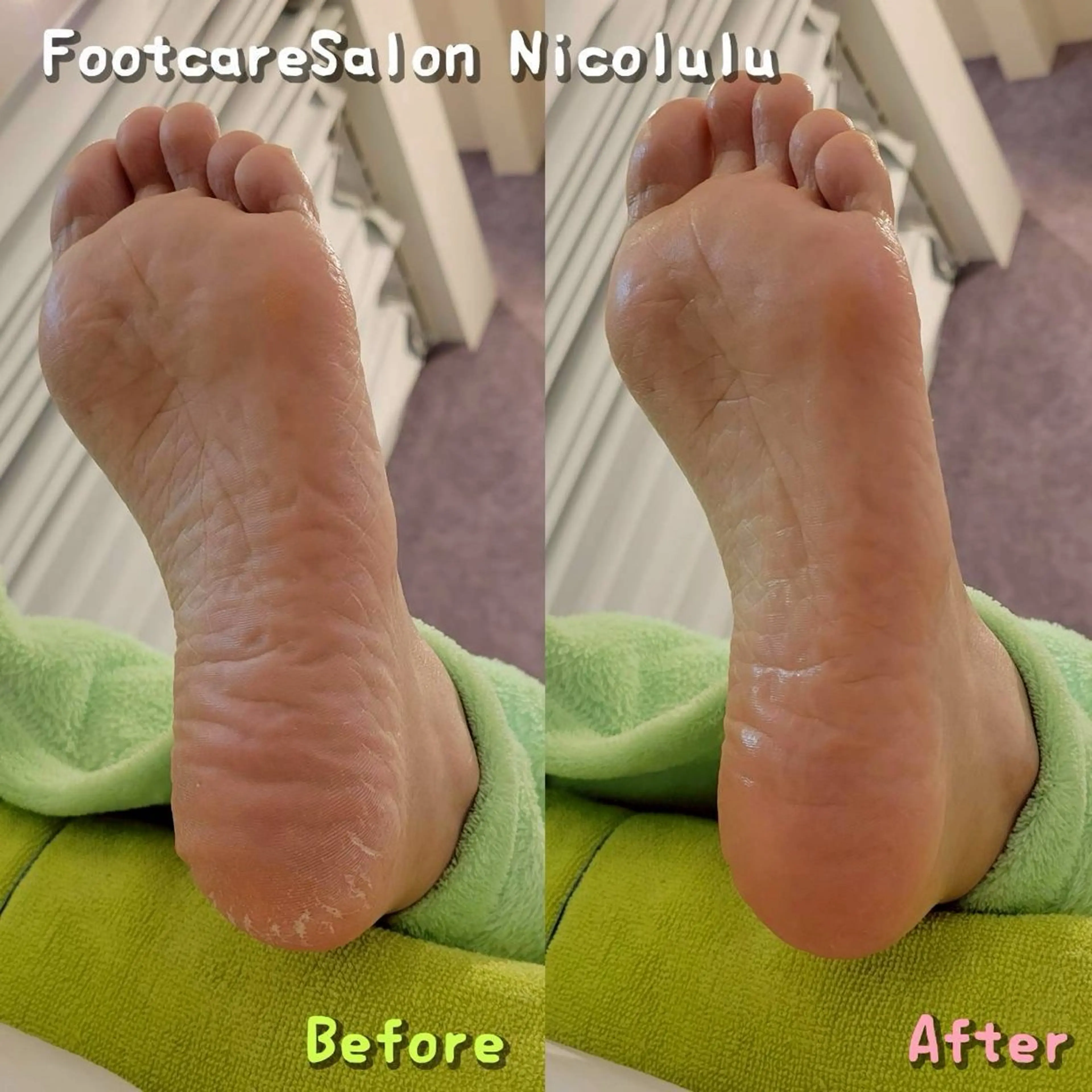 リラク 足トラブル専門 ニコルル金沢のエステ・リラクイメージ