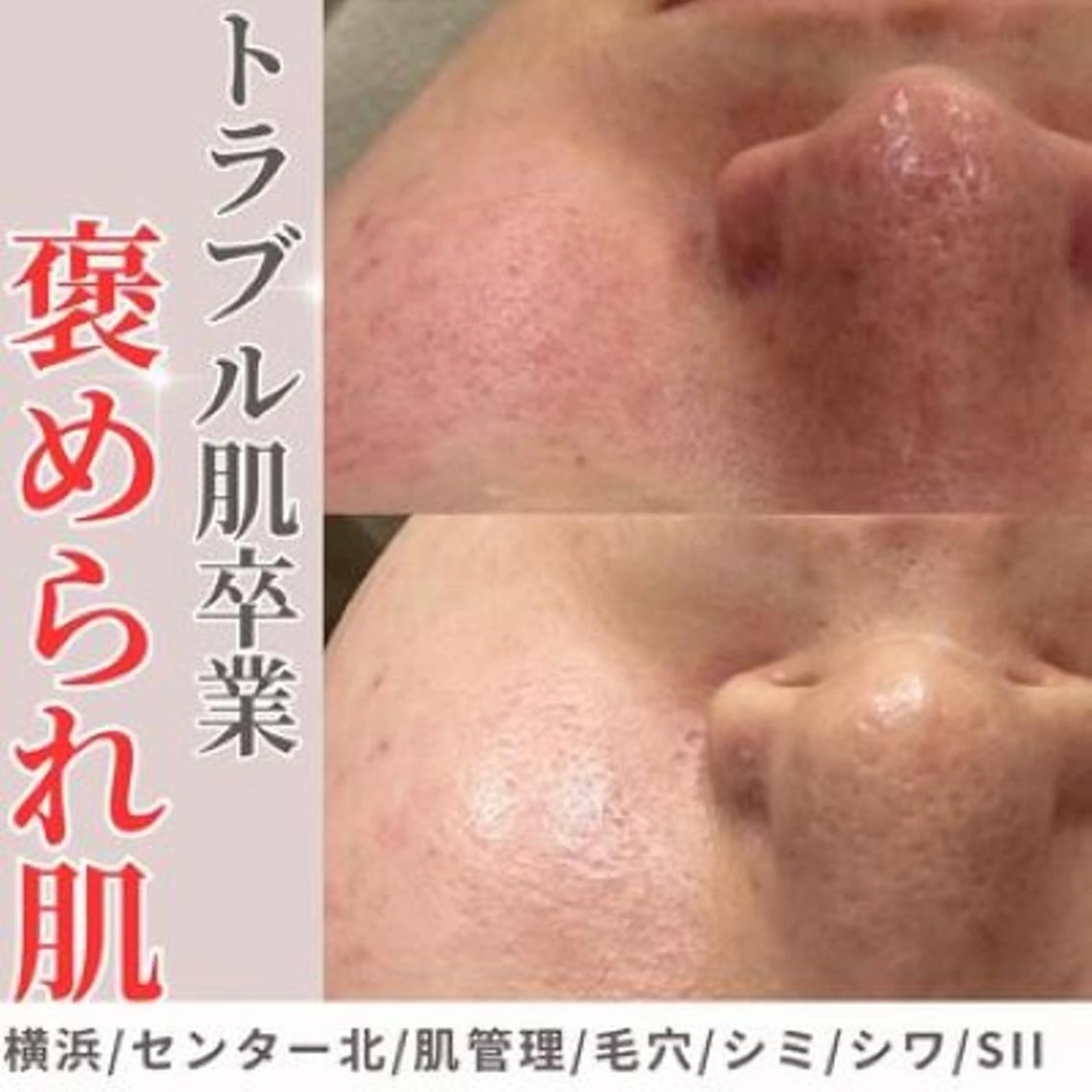 sii センター北 MANAのエステ・リラクイメージ