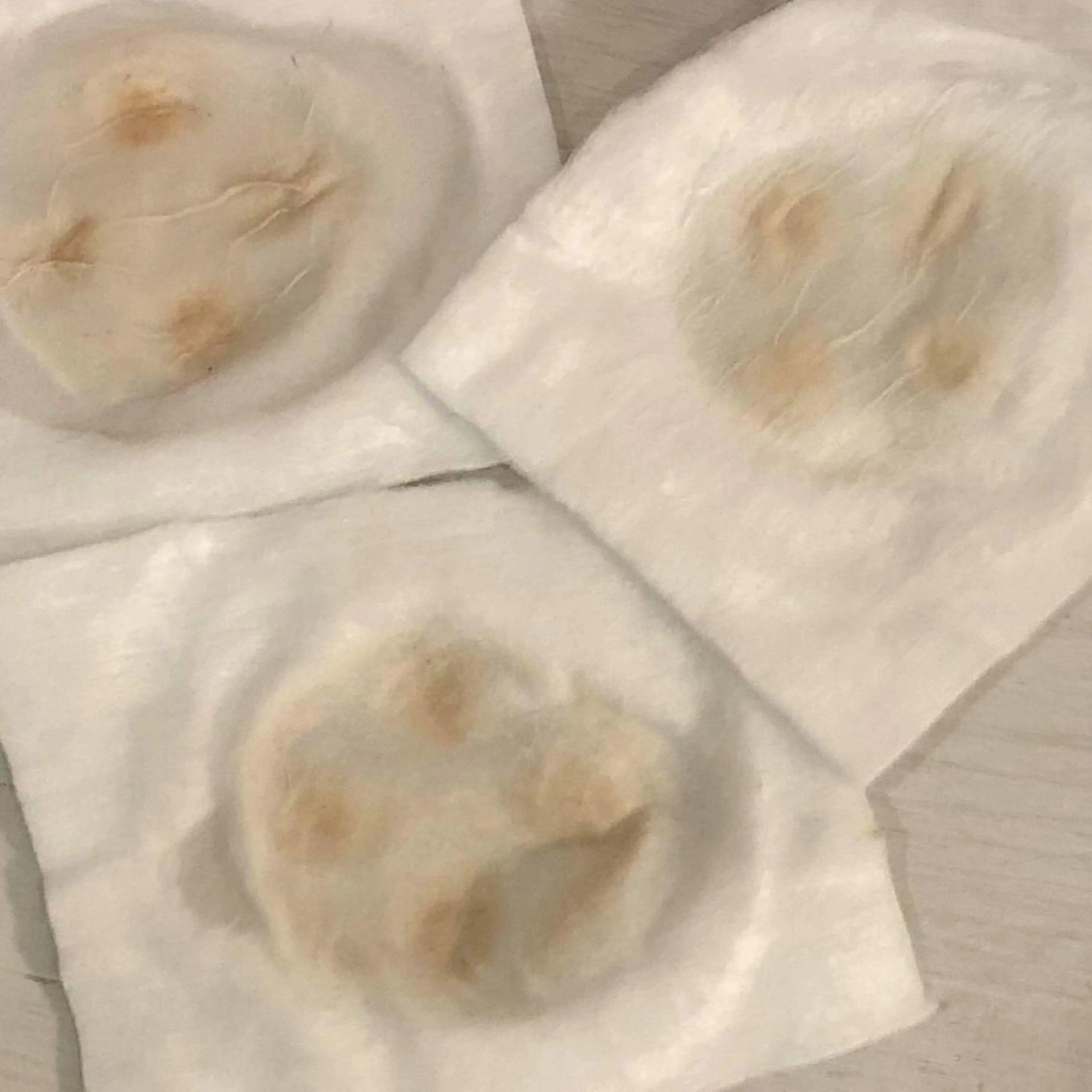 セルキュア4Tプラス！汚れがみえます！エレクトロクレンジング（オプション）の写真