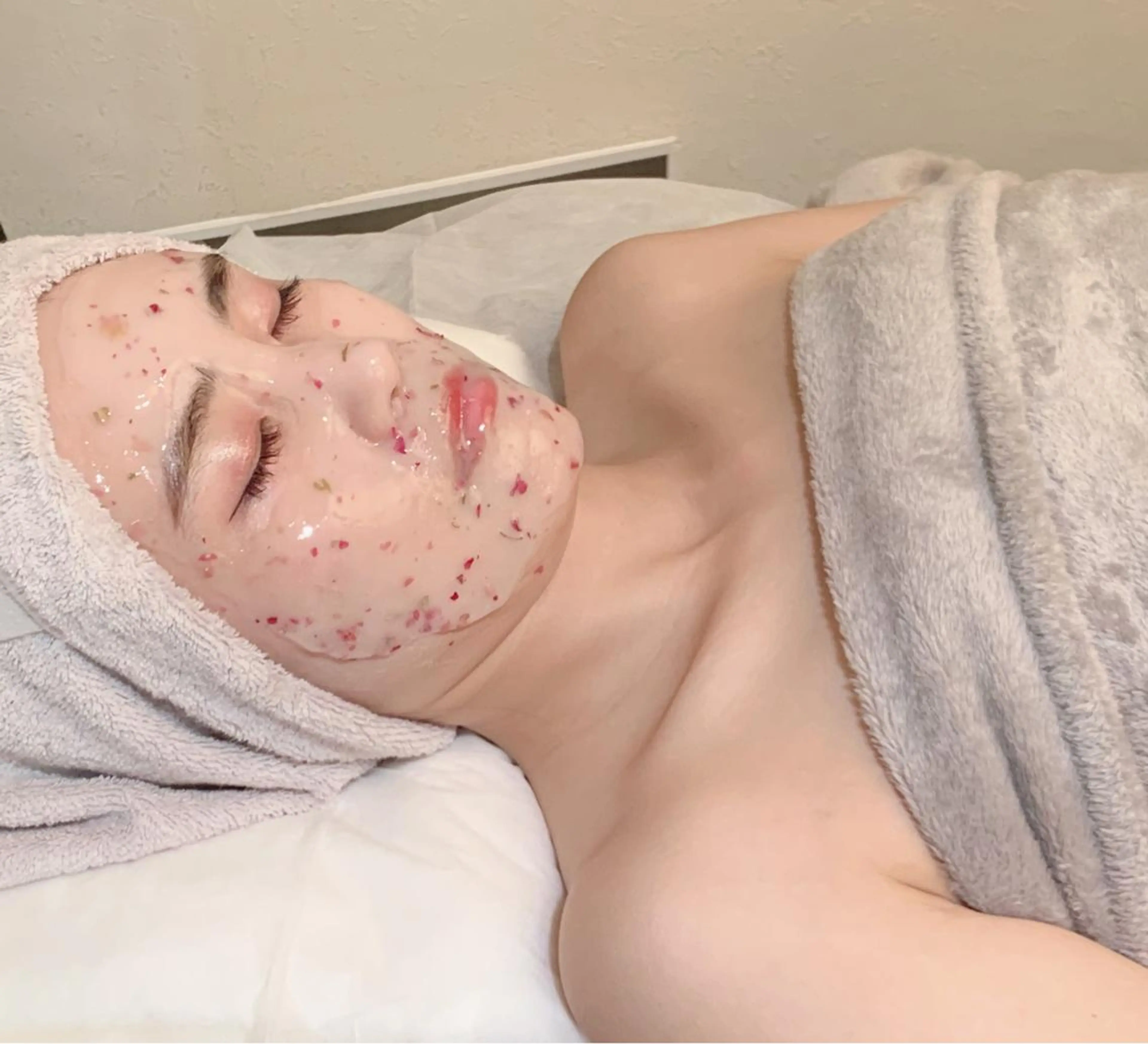 【フォト☆フェイシャル30分】シミ、くすみ、開き毛穴にラジオ派を真皮層にあてる美肌ケア◎の写真