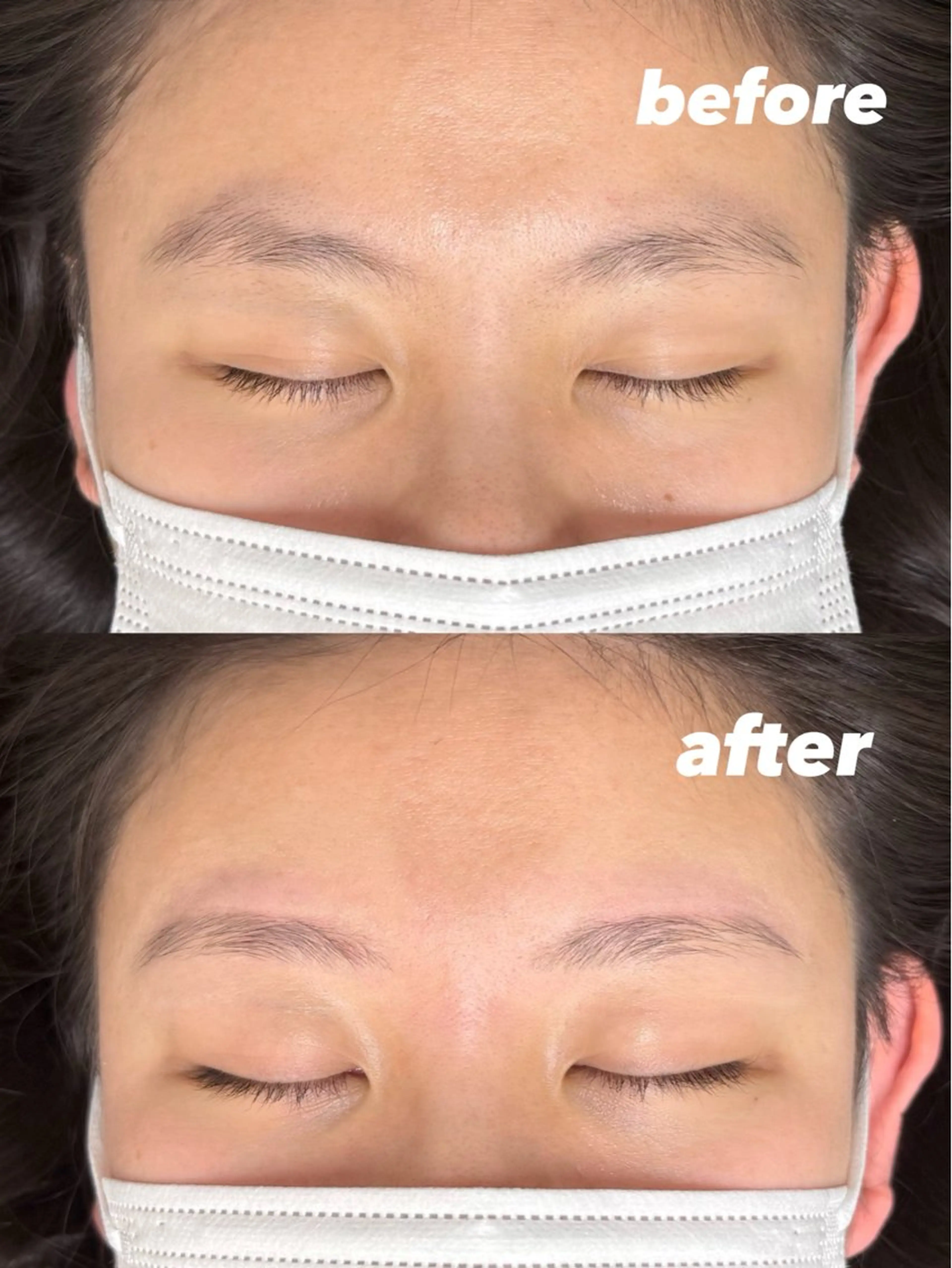 アイブロウ 眉毛ワックス脱毛 Mr.&Ms.脱毛 CHIHIROのエステ・リラクイメージ