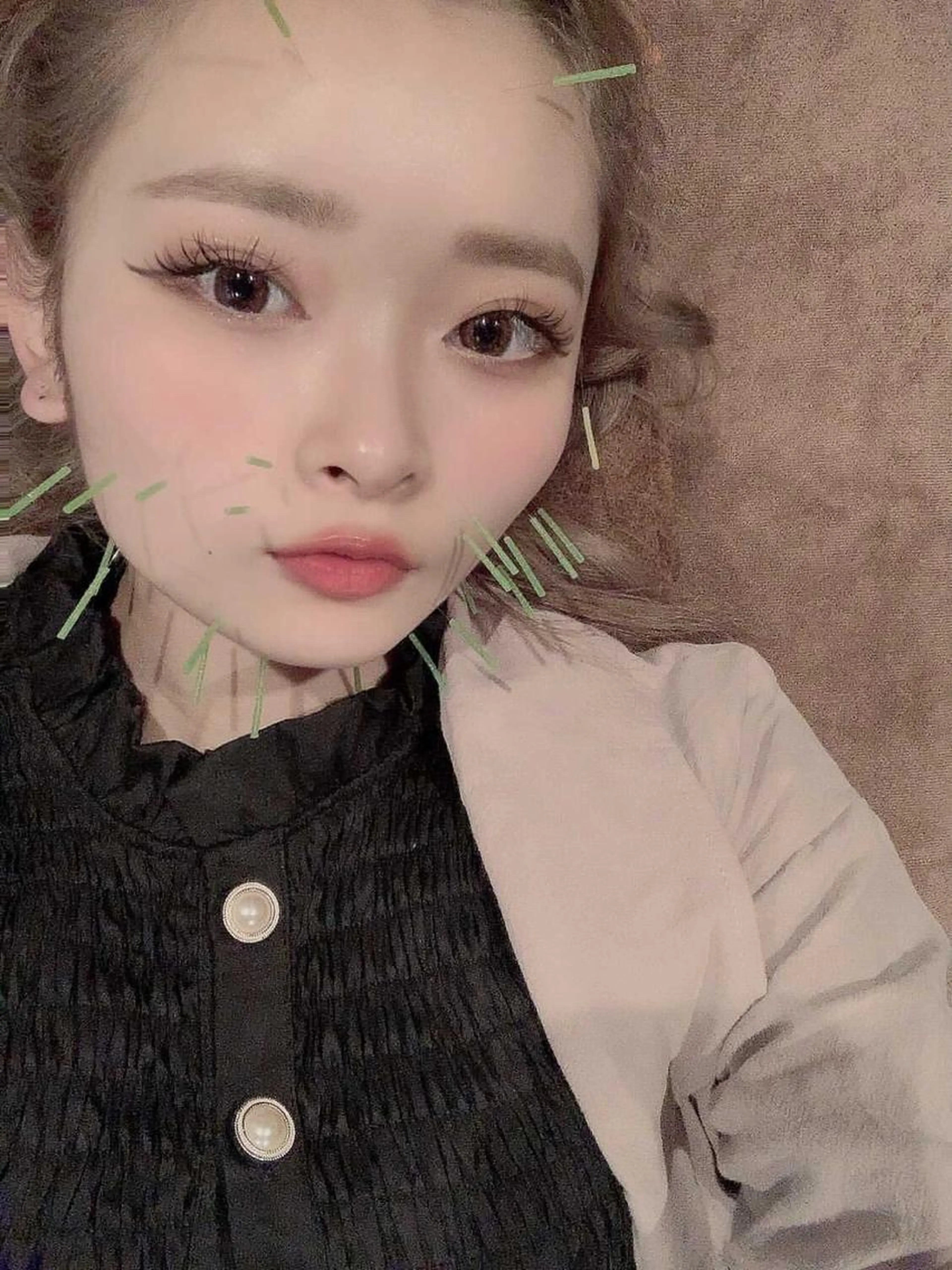 土日限定✨学割✨美容鍼初回期間限定⭐️(肩周り鍼付)の写真