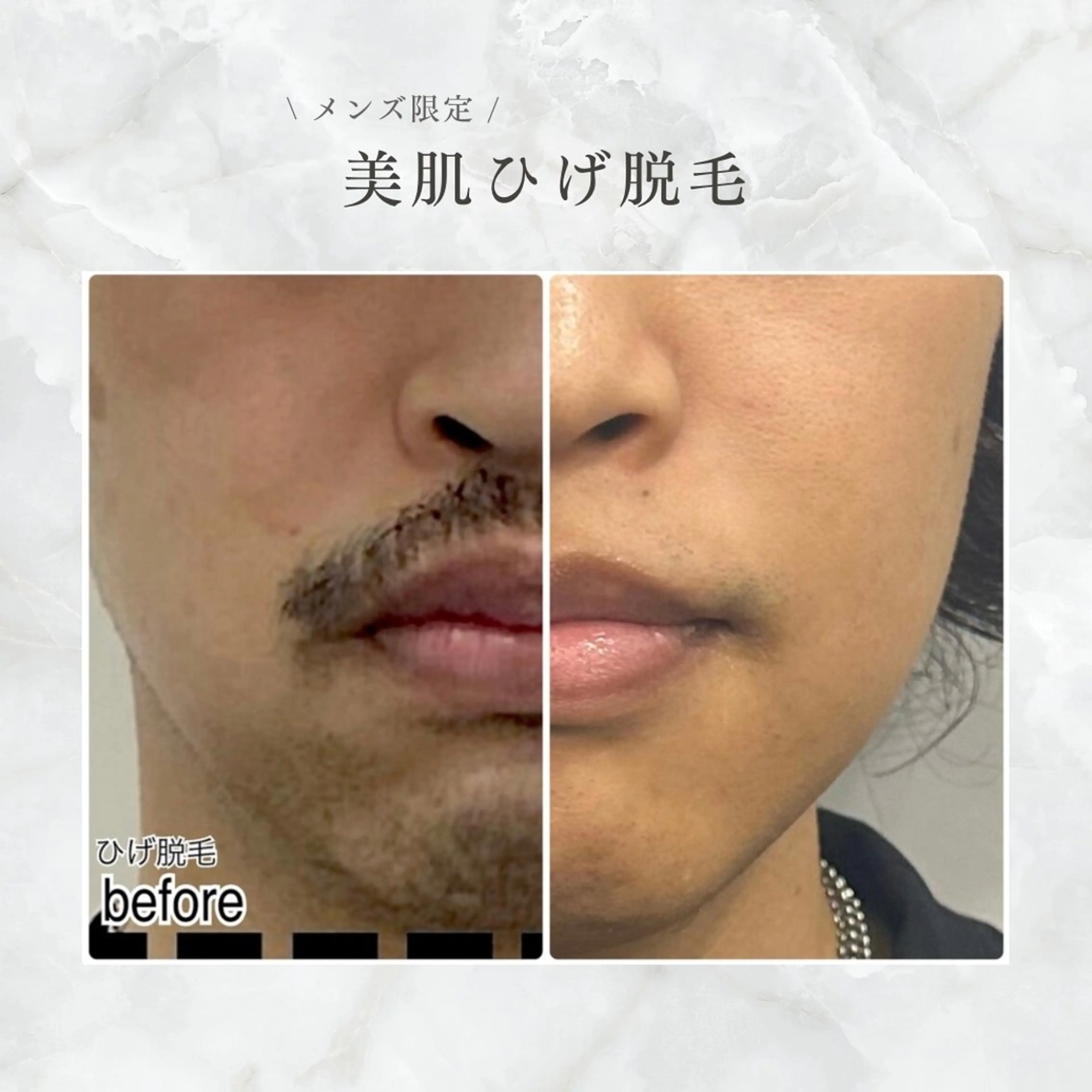 その他 ENCHANT Kaede/肌質改善のその他イメージ