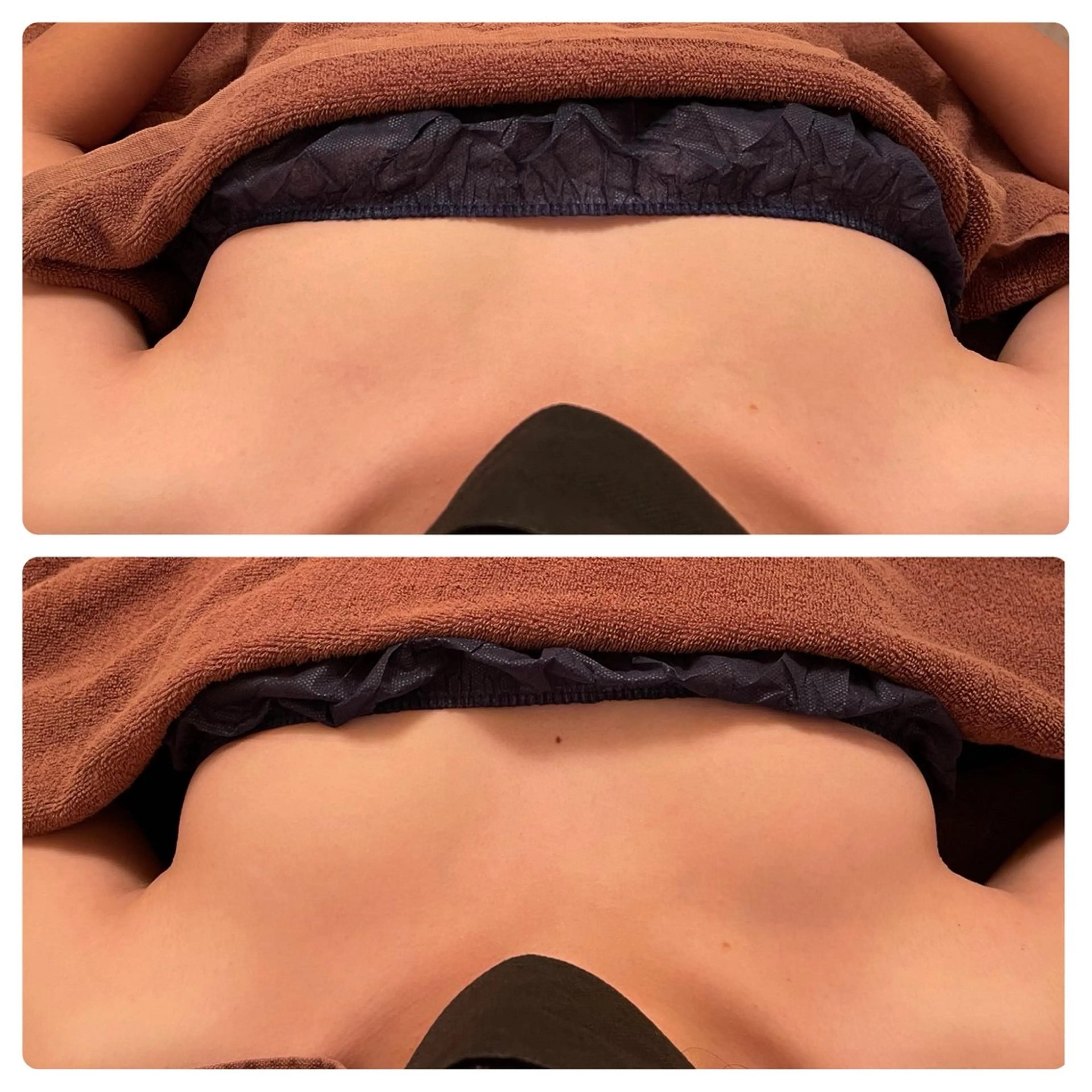 バストケア90分の写真