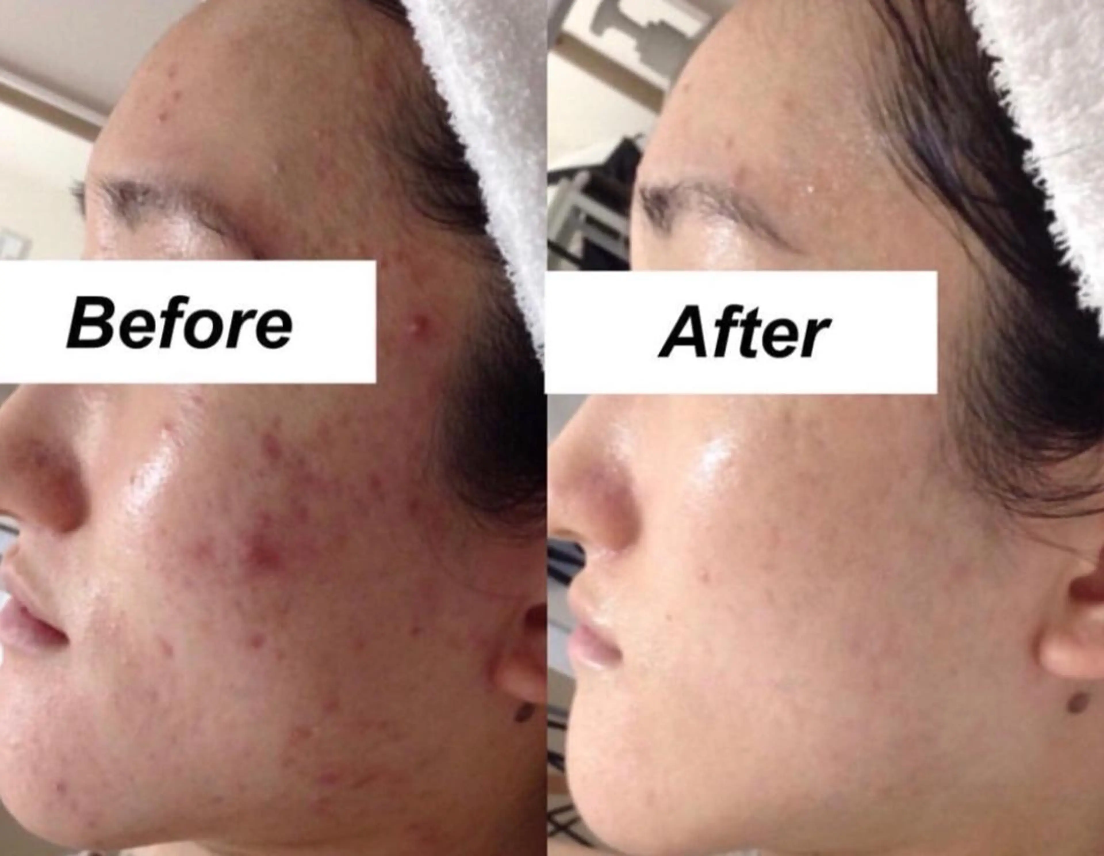 エステ リラク 都度払い肌質改善 &脱毛Blancheのエステ・リラクイメージ