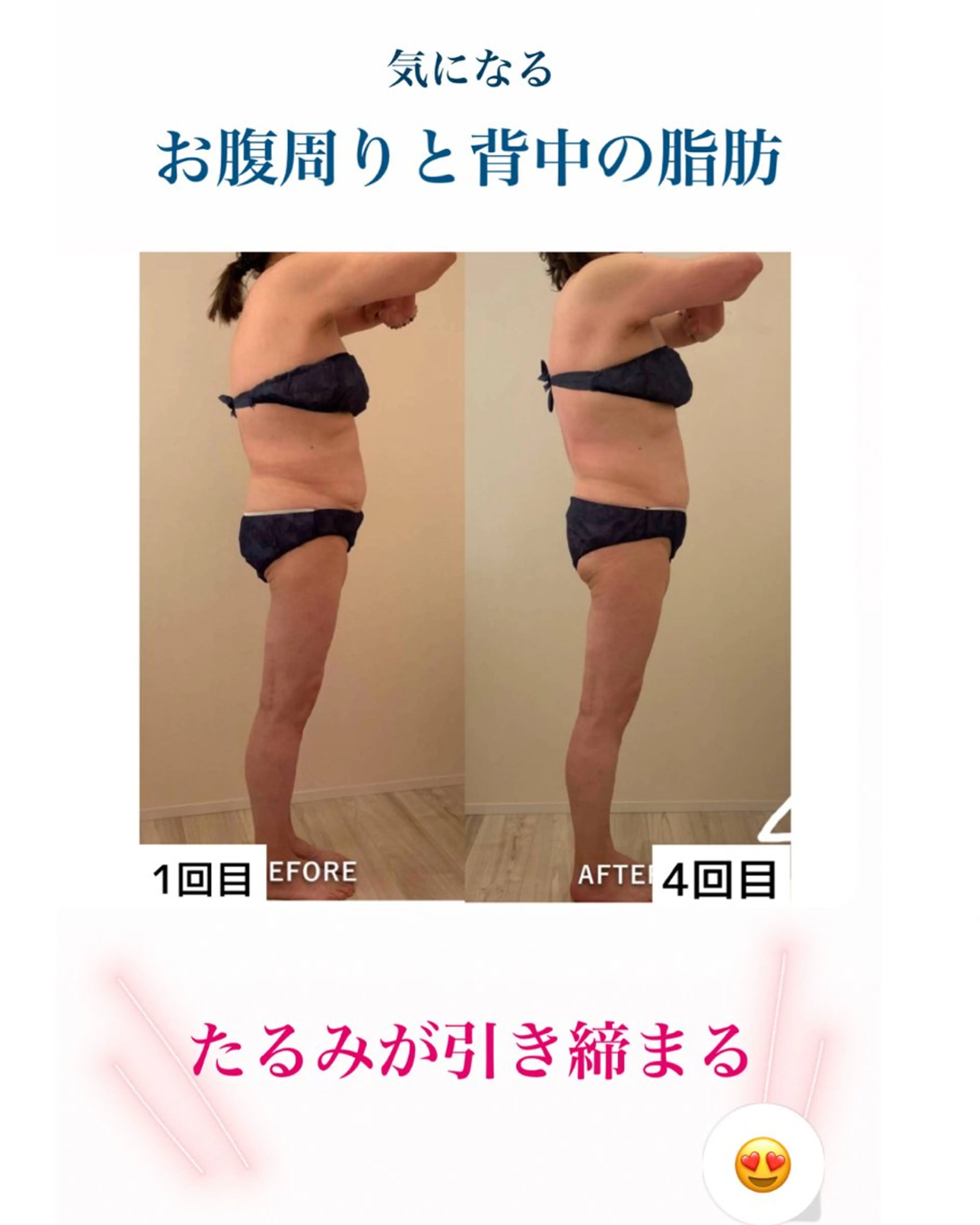 産後ダイエット−9㎏ Pourvous結衣のエステ・リラクイメージ