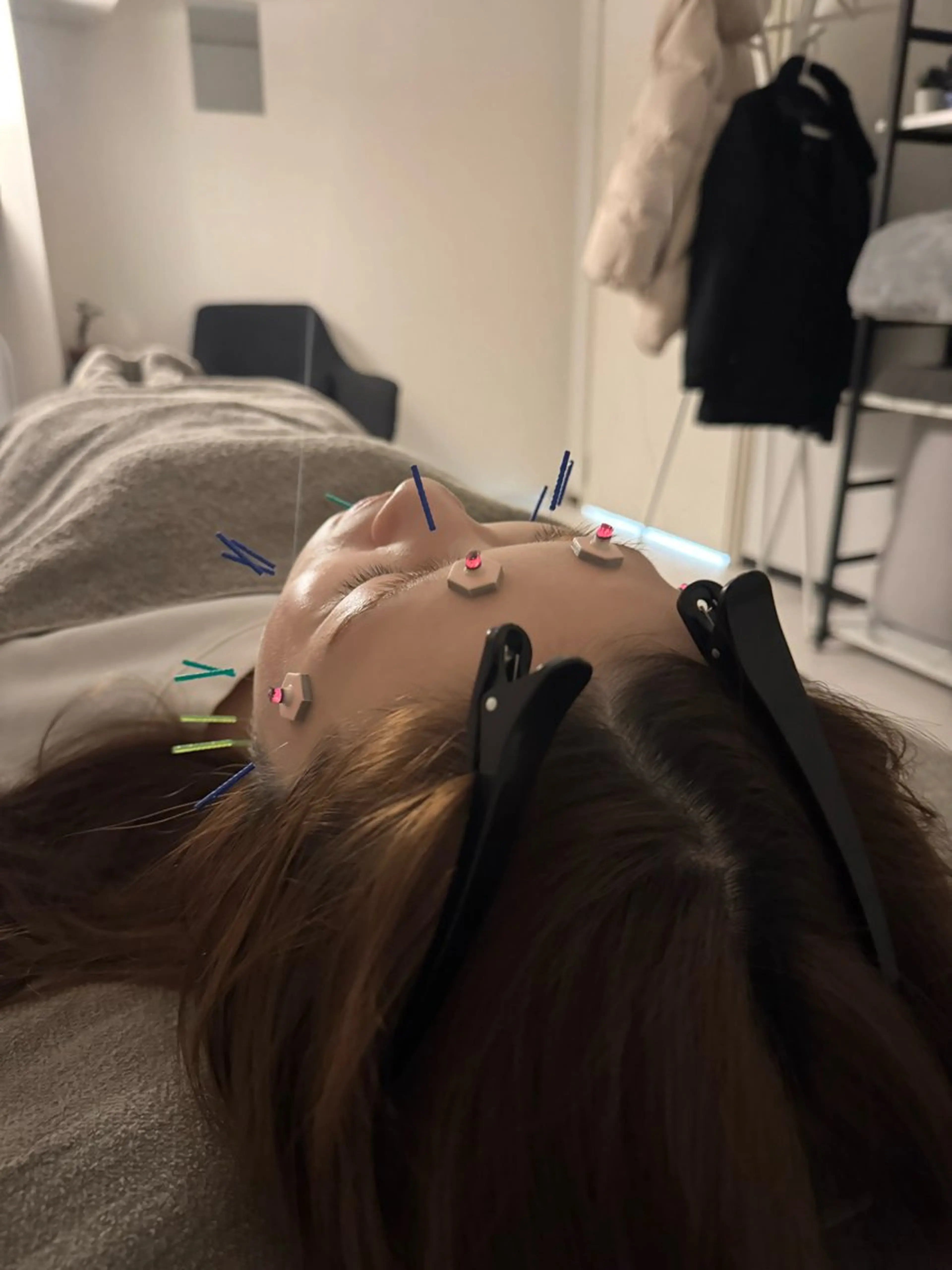 エステ リラク 美容鍼×小顔矯正 ×美容整体　浜川泰仁のエステ・リラクイメージ