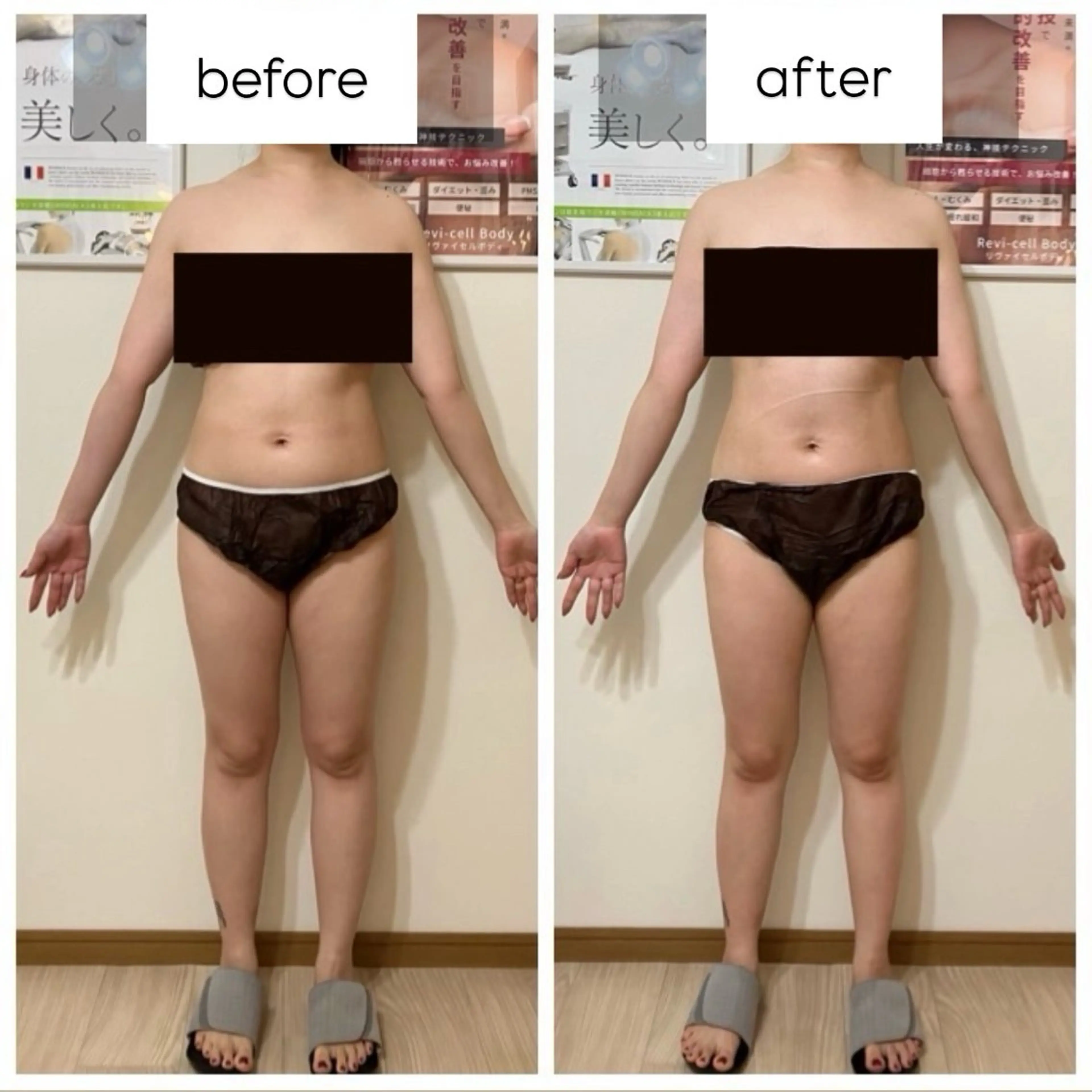 エステ リラク 未病ケアサロン　EMINY所属・未病ケアサロン EMINY☺︎勝俣のエステ・リラクイメージ