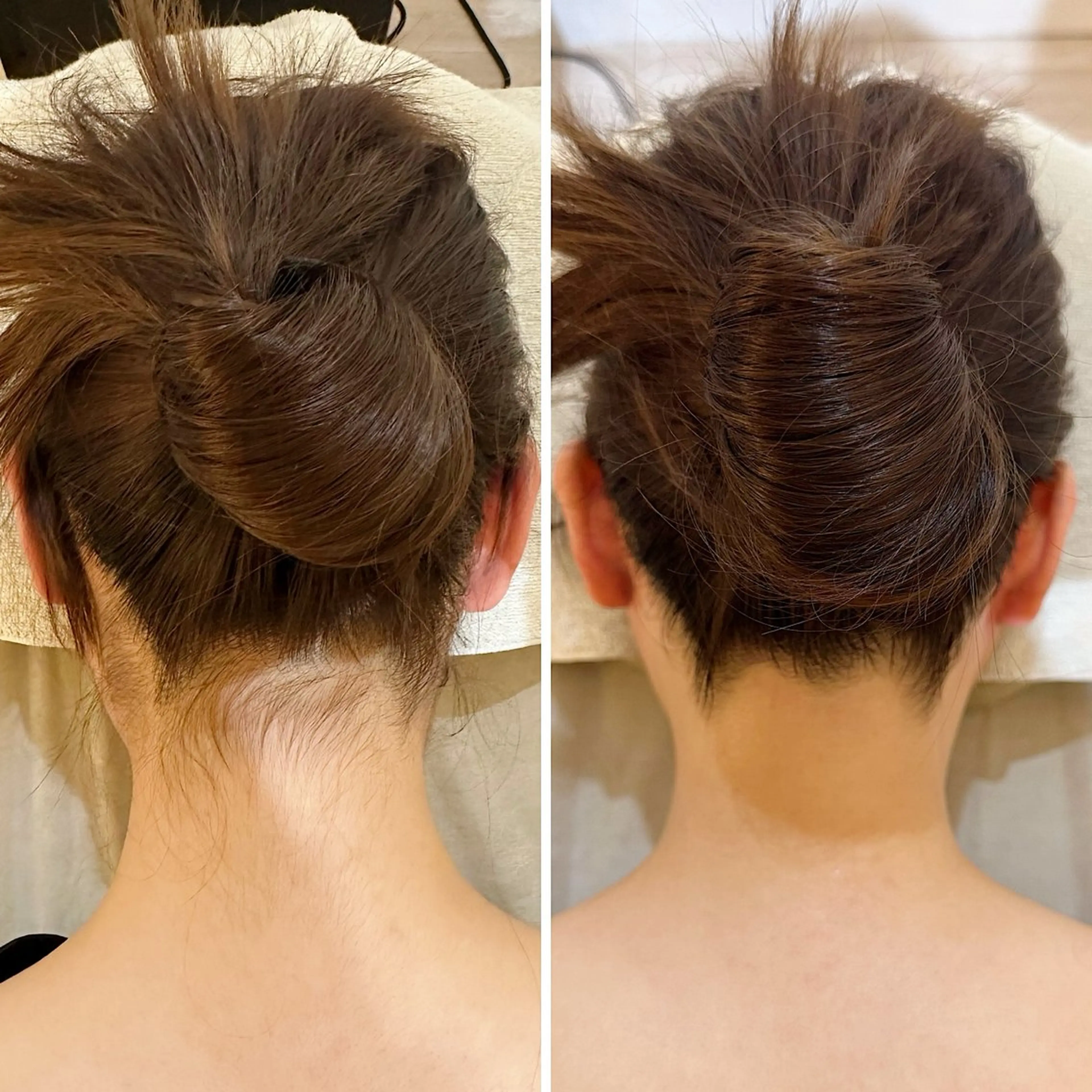 脱毛 うなじ脱毛/美肌脱毛 LABELのエステ・リラクイメージ