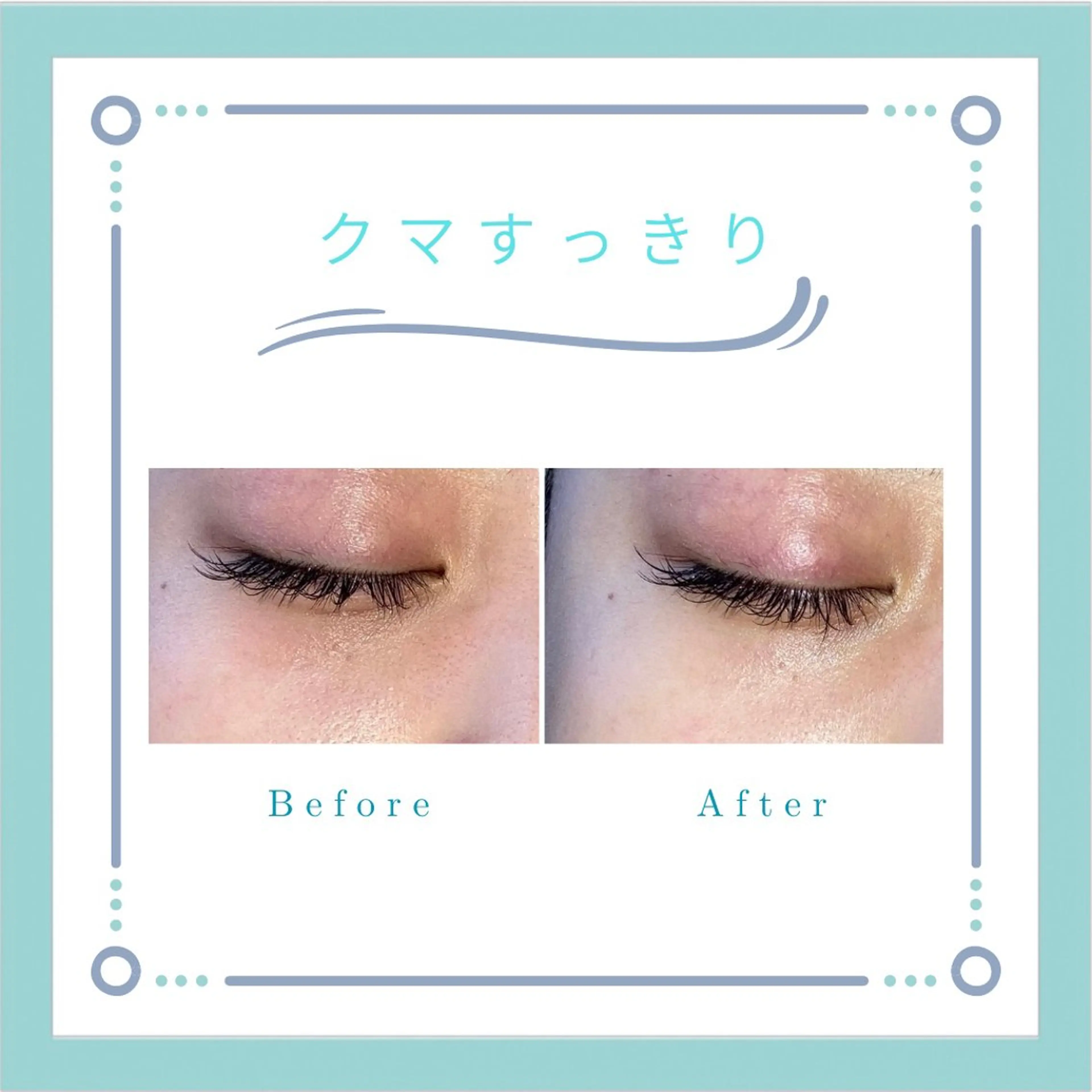 フェイシャルエステLe・Ciel所属・Le・Ciel フェイシャル&ボディのエステ・リラクイメージ