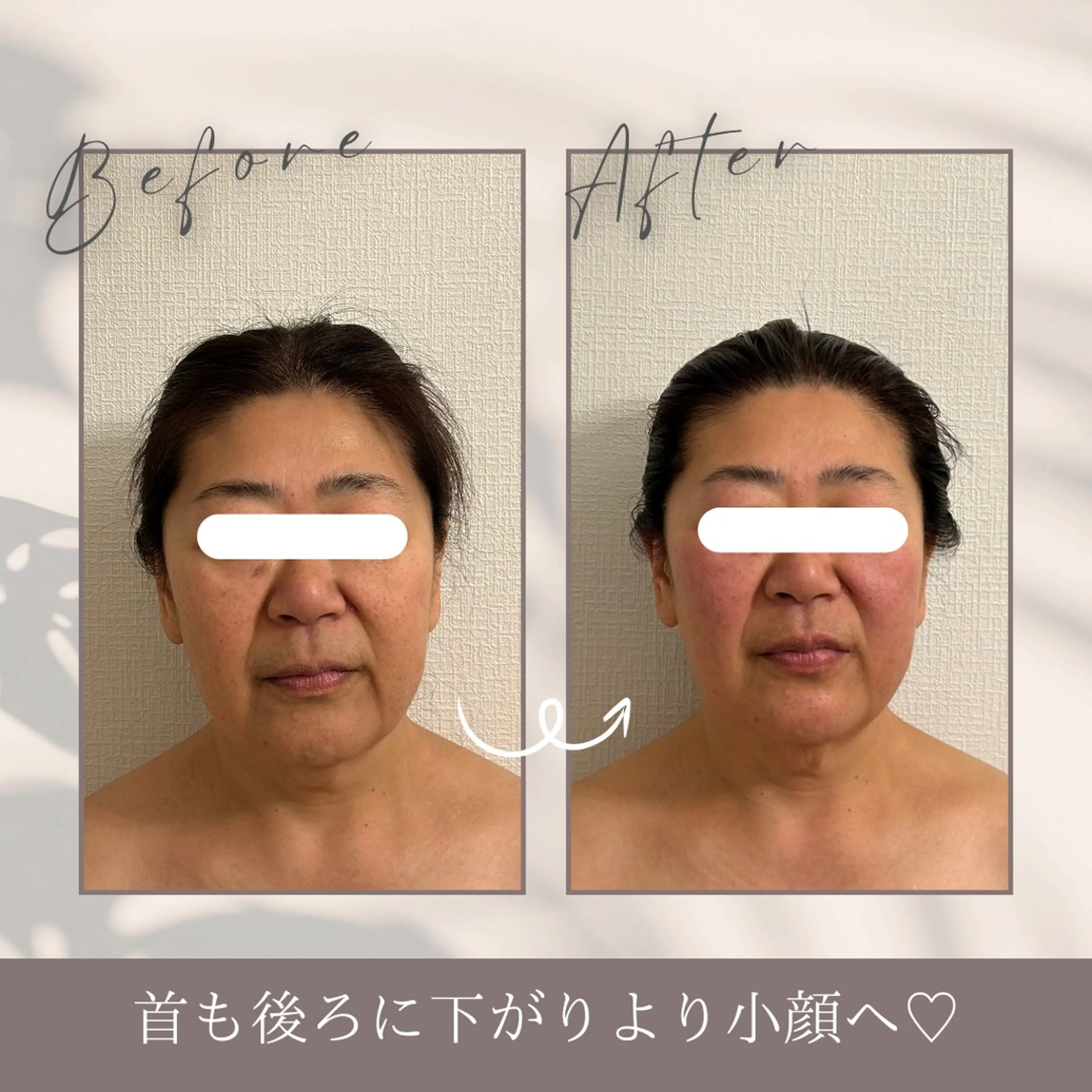 【単品メニュー】頭蓋調整の写真