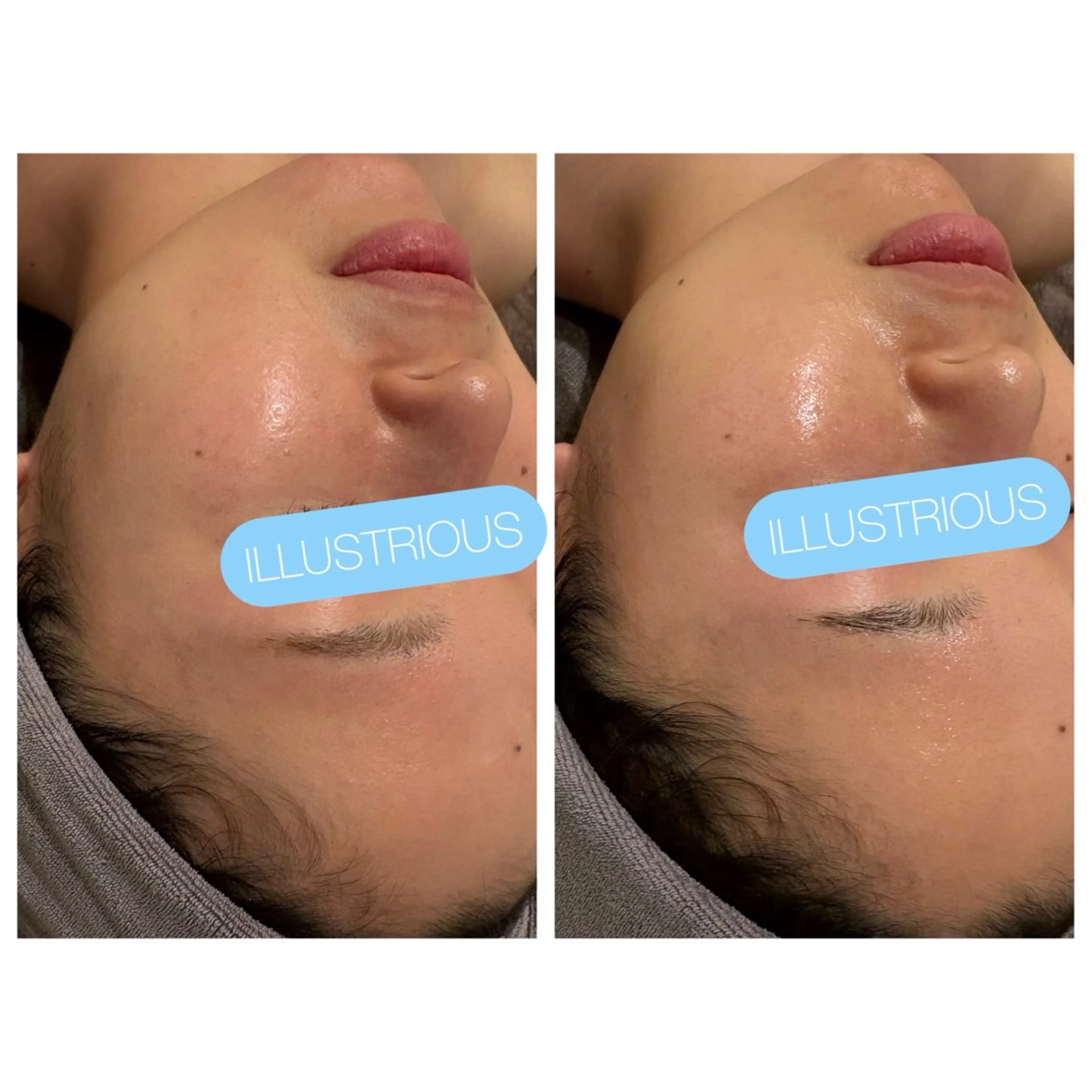 ☆痩身/小顔☆ コルギのエステ・リラクイメージ