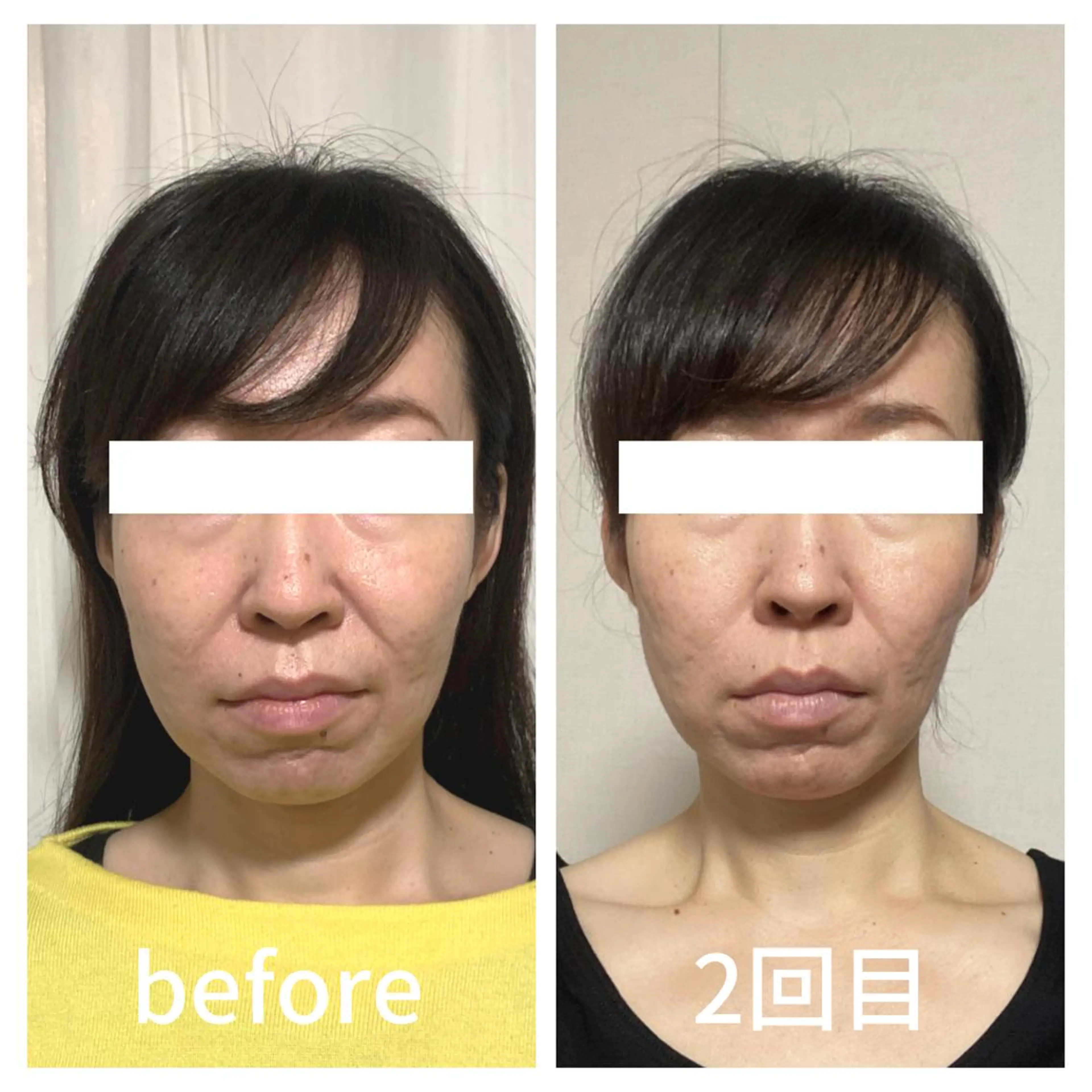 小顔サロン AMYONのエステ・リラクイメージ