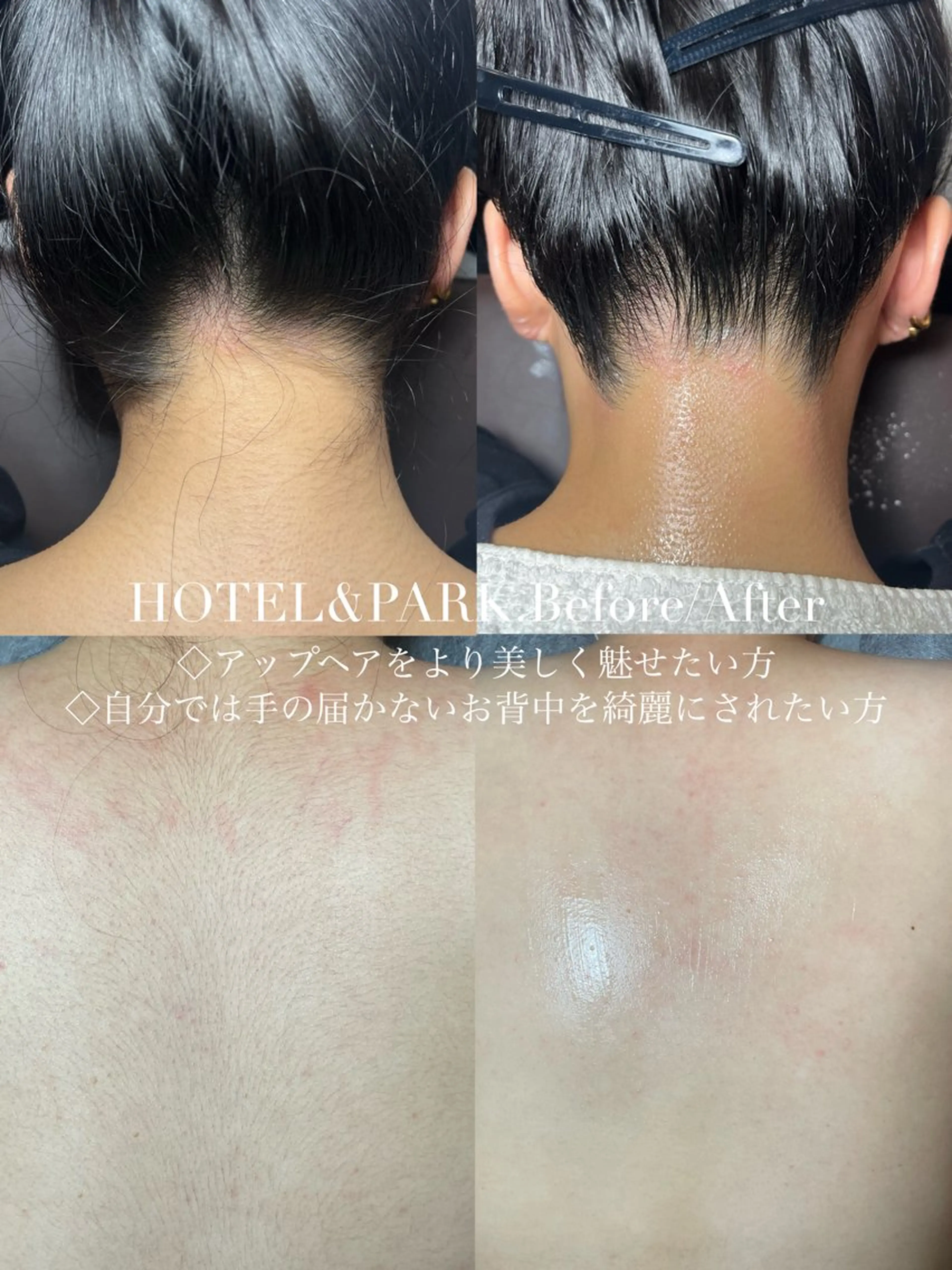 HOTEL&PARK Mikuワックス脱毛のエステ・リラクイメージ