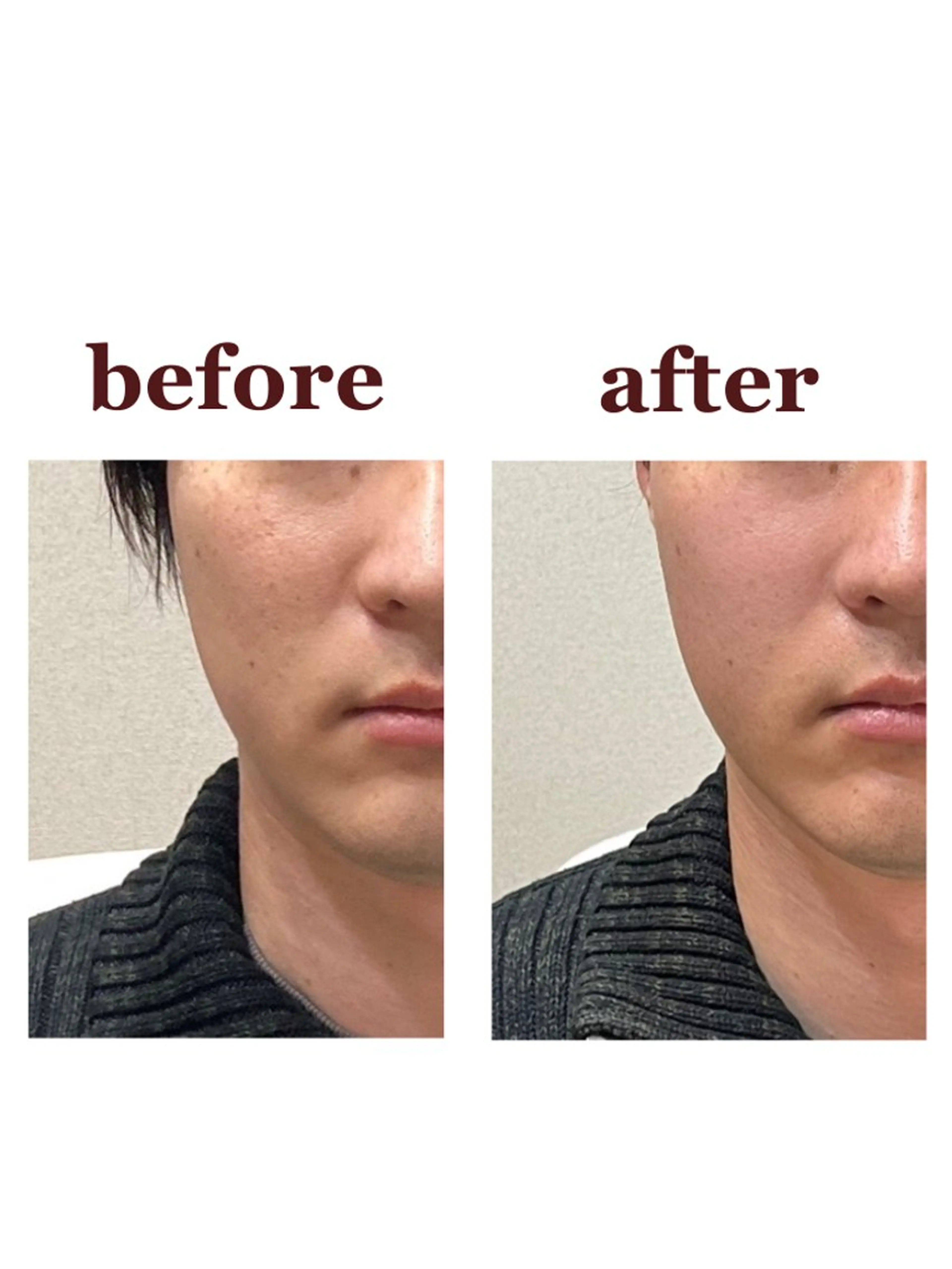 NailBeauty marcherのエステ・リラクイメージ