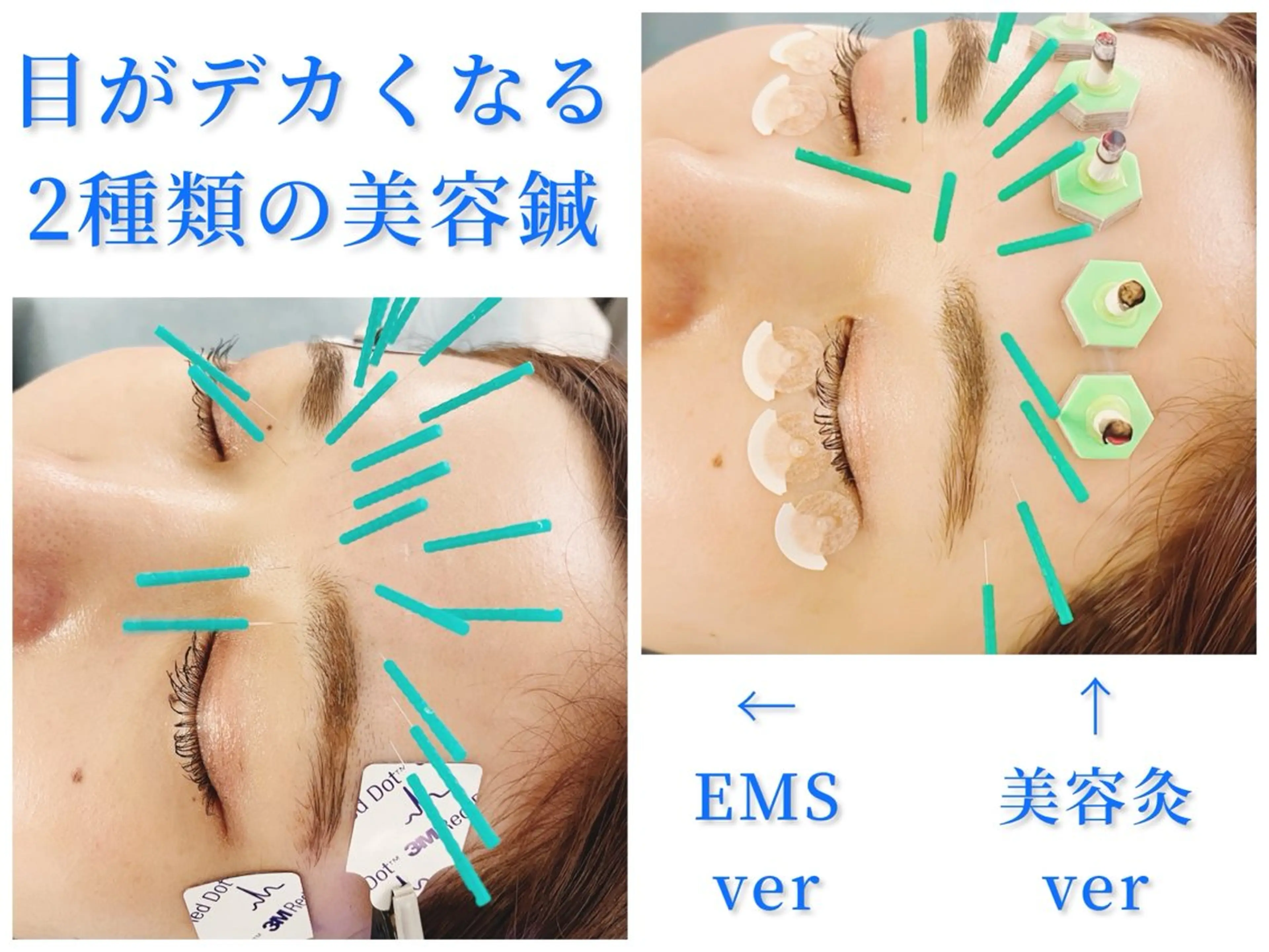 小顔美容鍼専門サロン 渋谷YZのその他イメージ