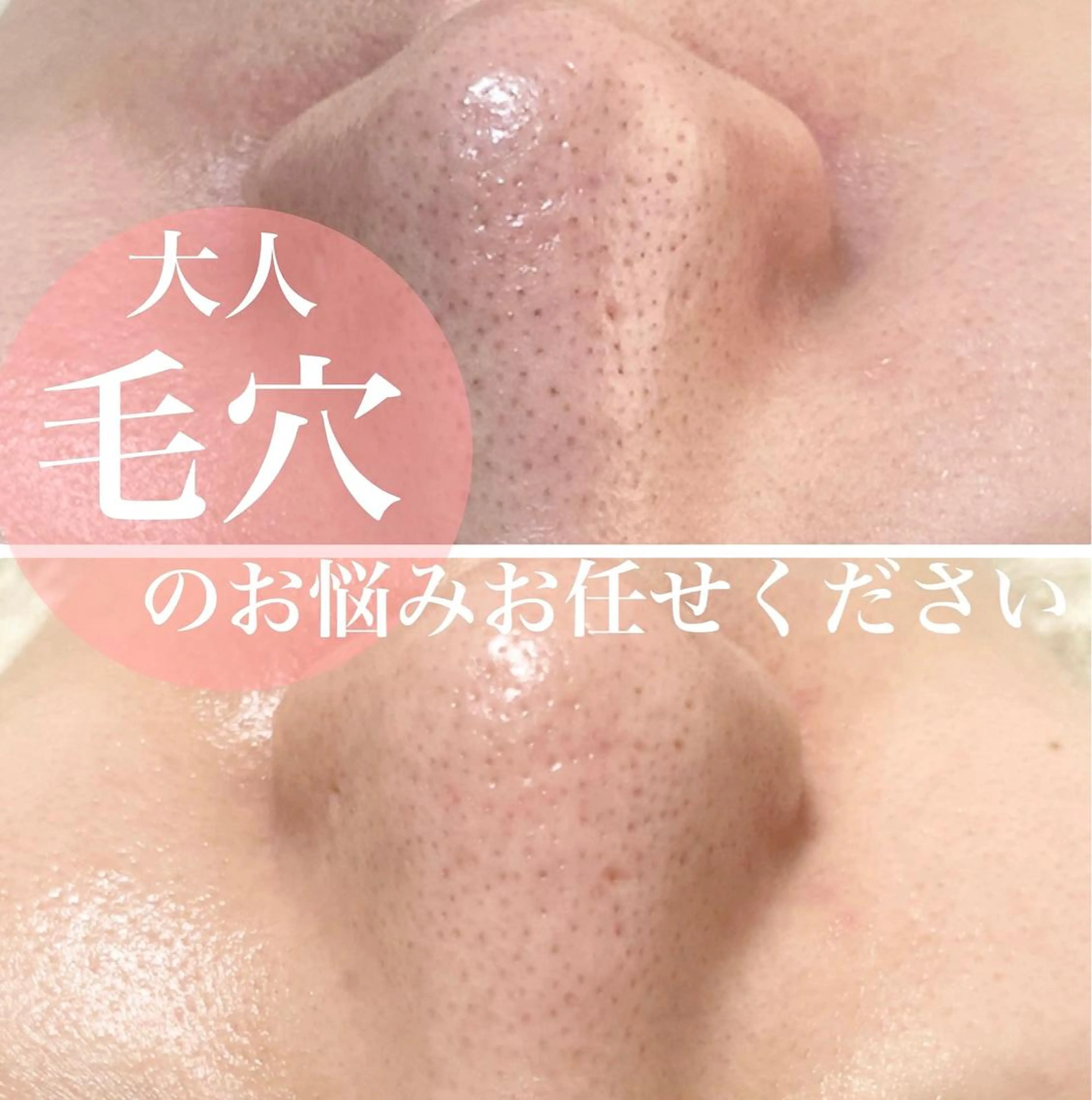 【本気毛穴ケア】毛穴集中洗浄全顔つるん。癒しのデコルテマッサージ付き　定価14,300円の写真