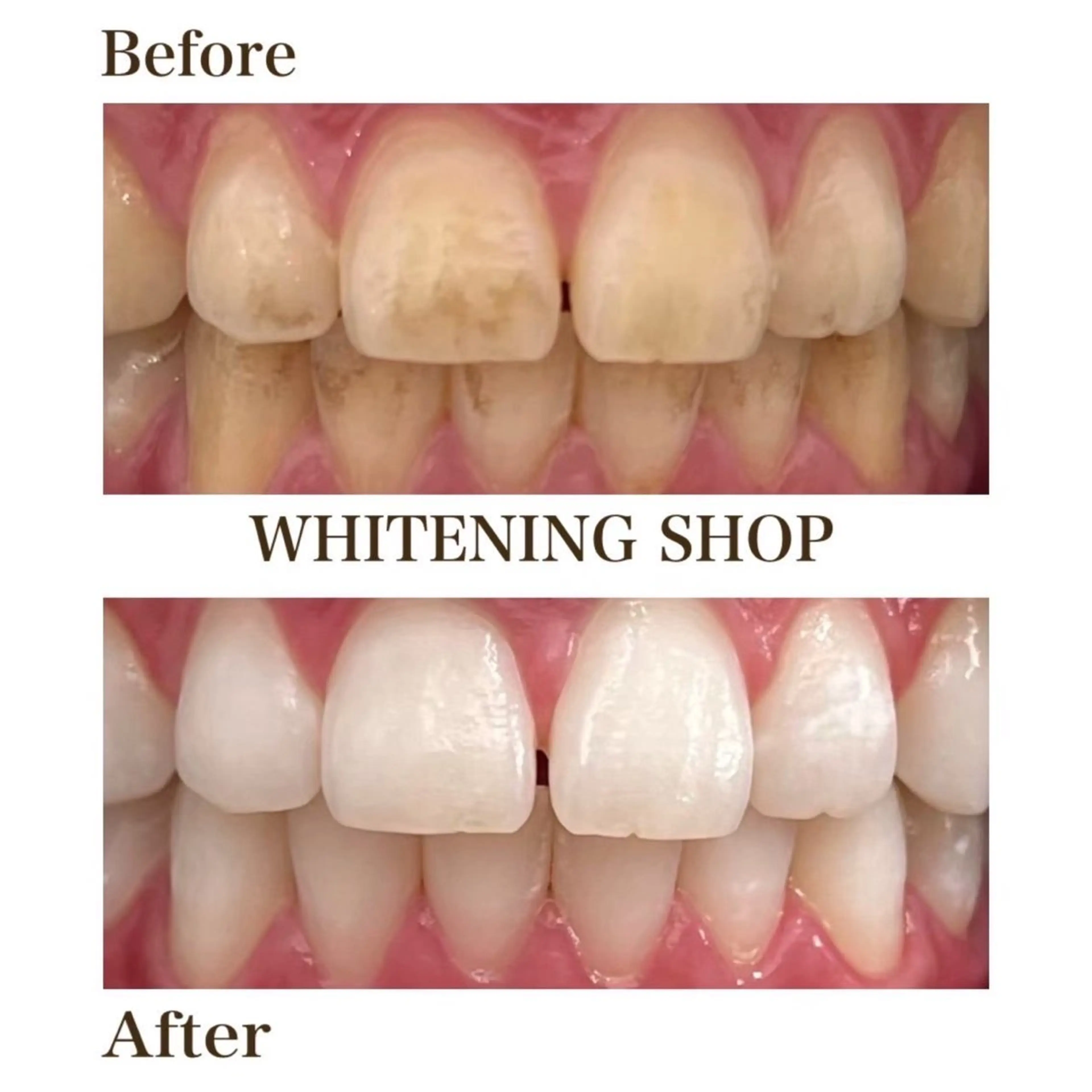 ホワイトニングショップ伊丹店所属・ホワイトニング ショップ伊丹店のその他イメージ