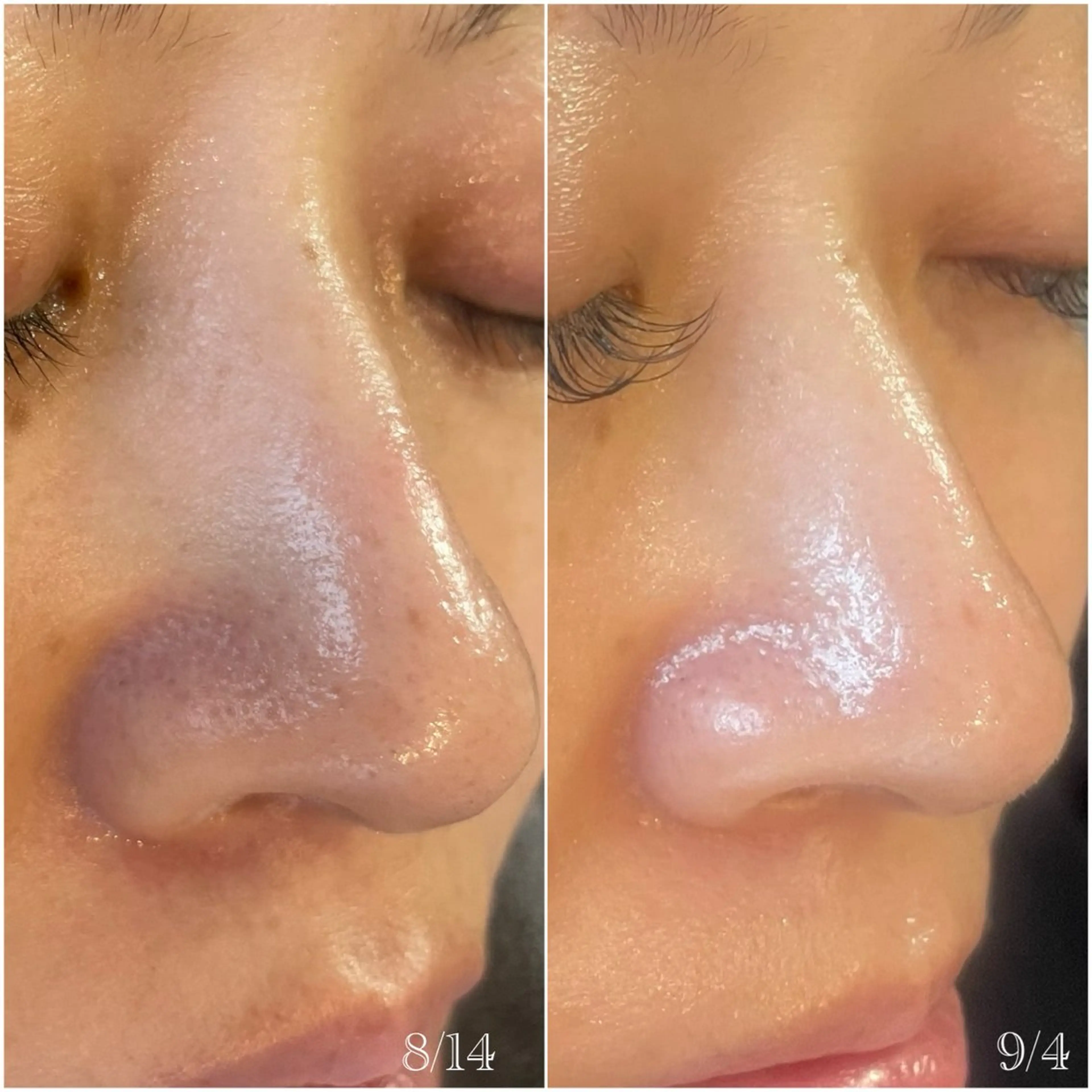 フィユ所属・〚博多〛フィユ 水江のマツエク・マツパデザイン