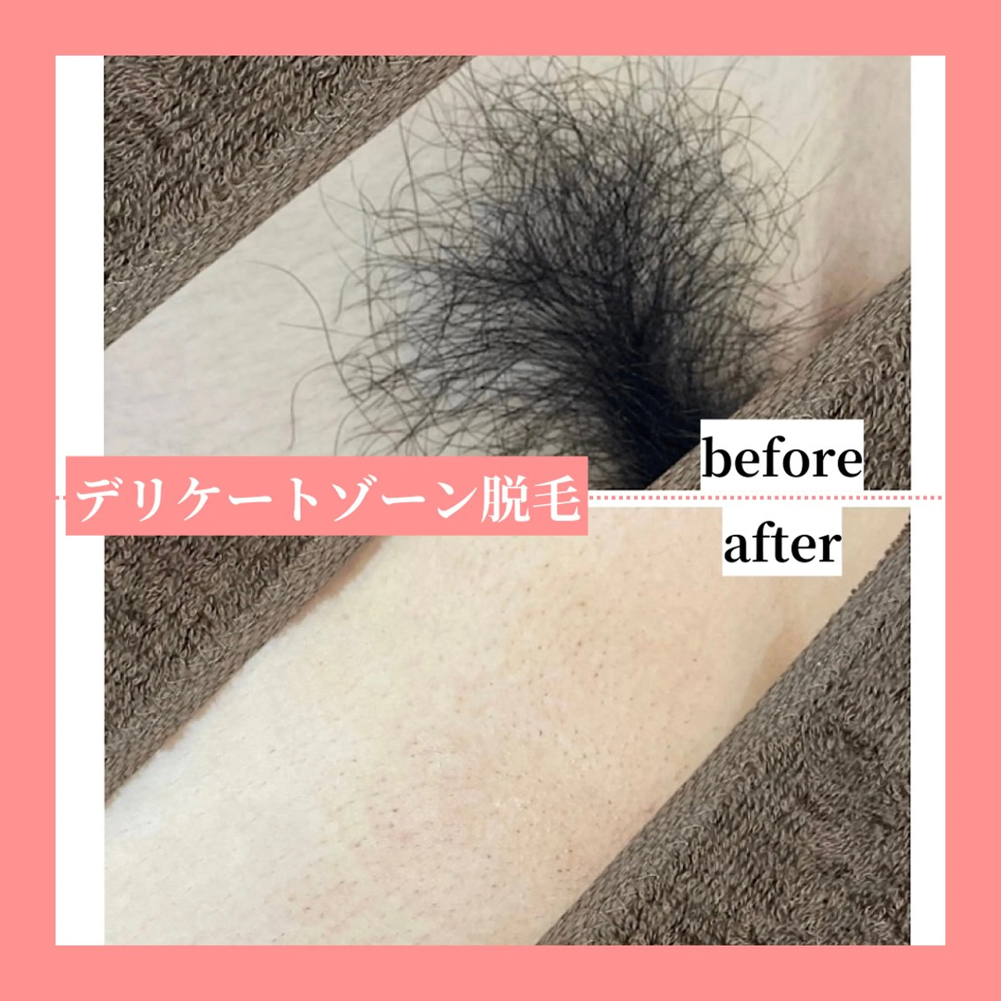 メンズ 天神【効果重視脱毛】 YouMakeのエステ・リラクイメージ