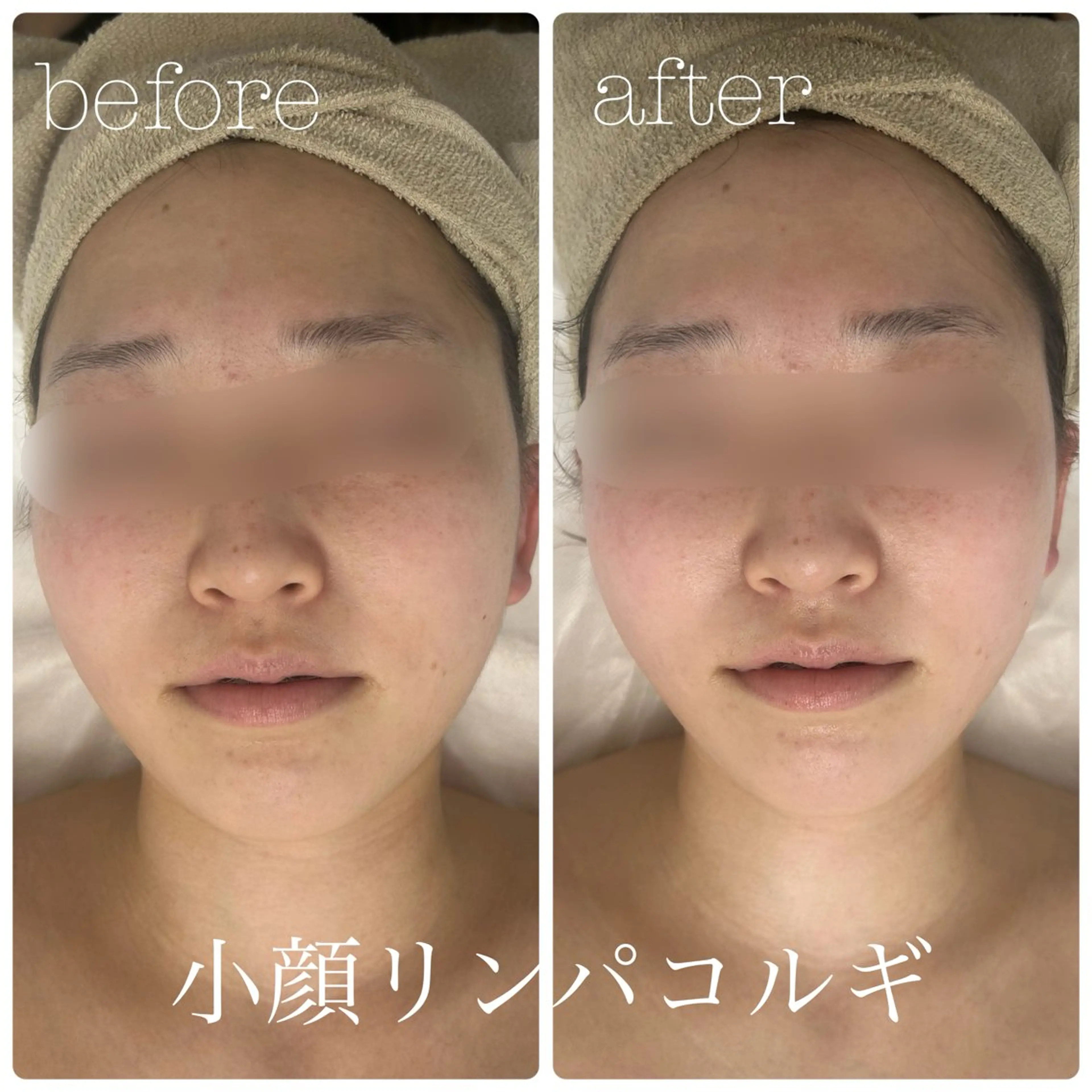 フェイシャルサロン CHIARA 荒田のエステ・リラクイメージ