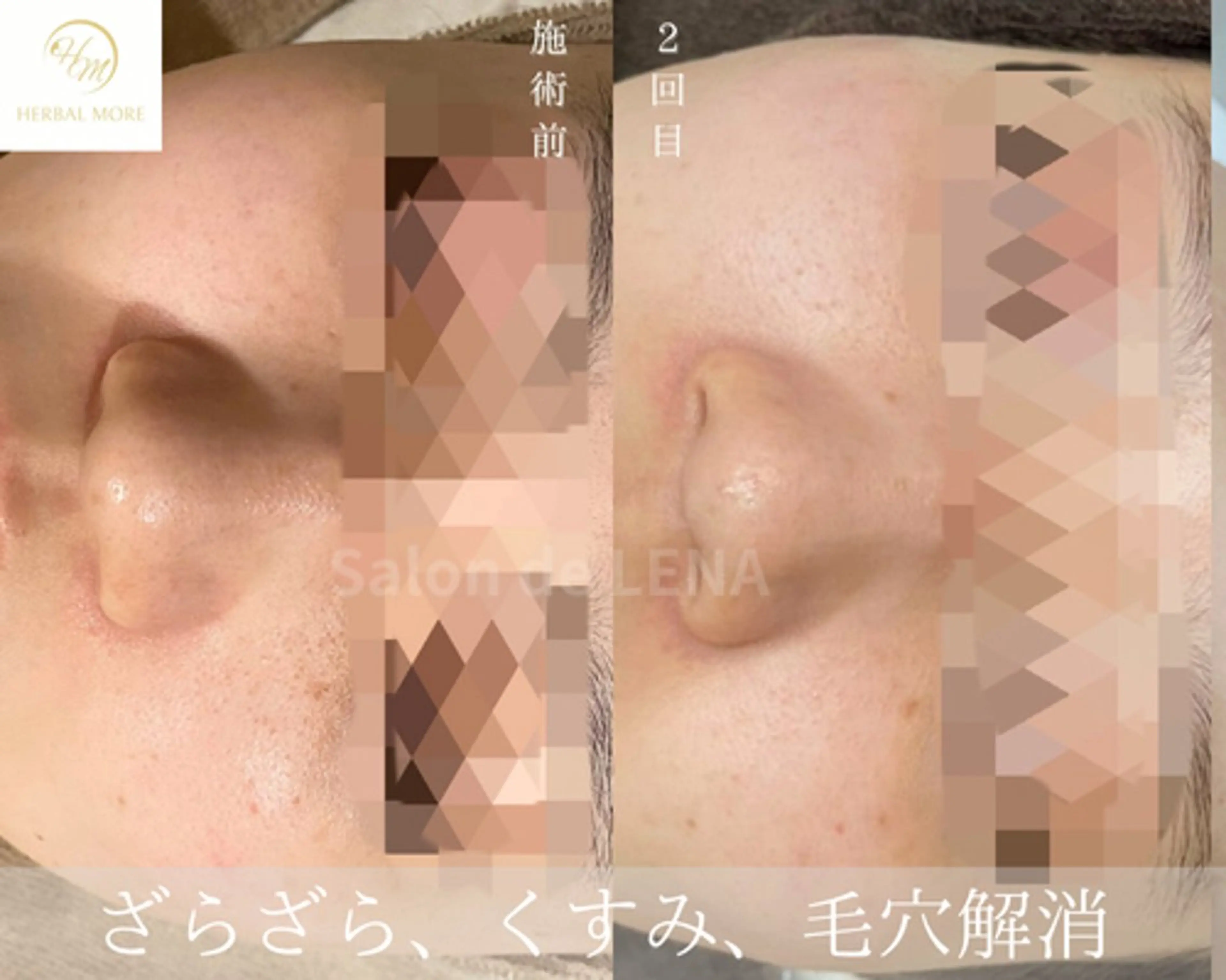 ハーブピーリング・毛穴ケア専門サロンSalon de LENA 栄店所属・ハーブピーリング専門 サロンドレナ　白藤のエステ・リラクイメージ