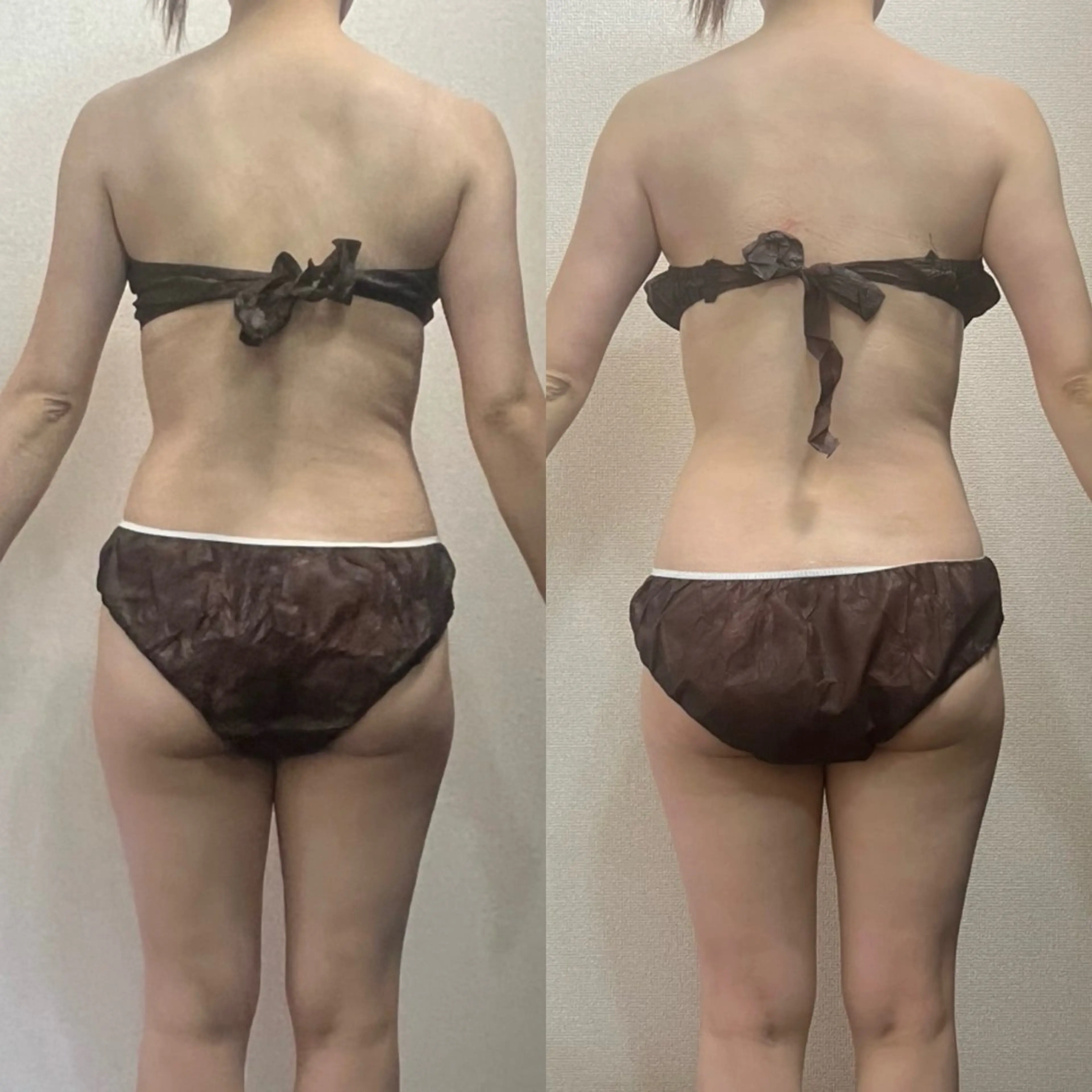 エステ ハイパーナイフ専門店　Salon de COCO所属・Salon de COCOのエステ・リラクイメージ