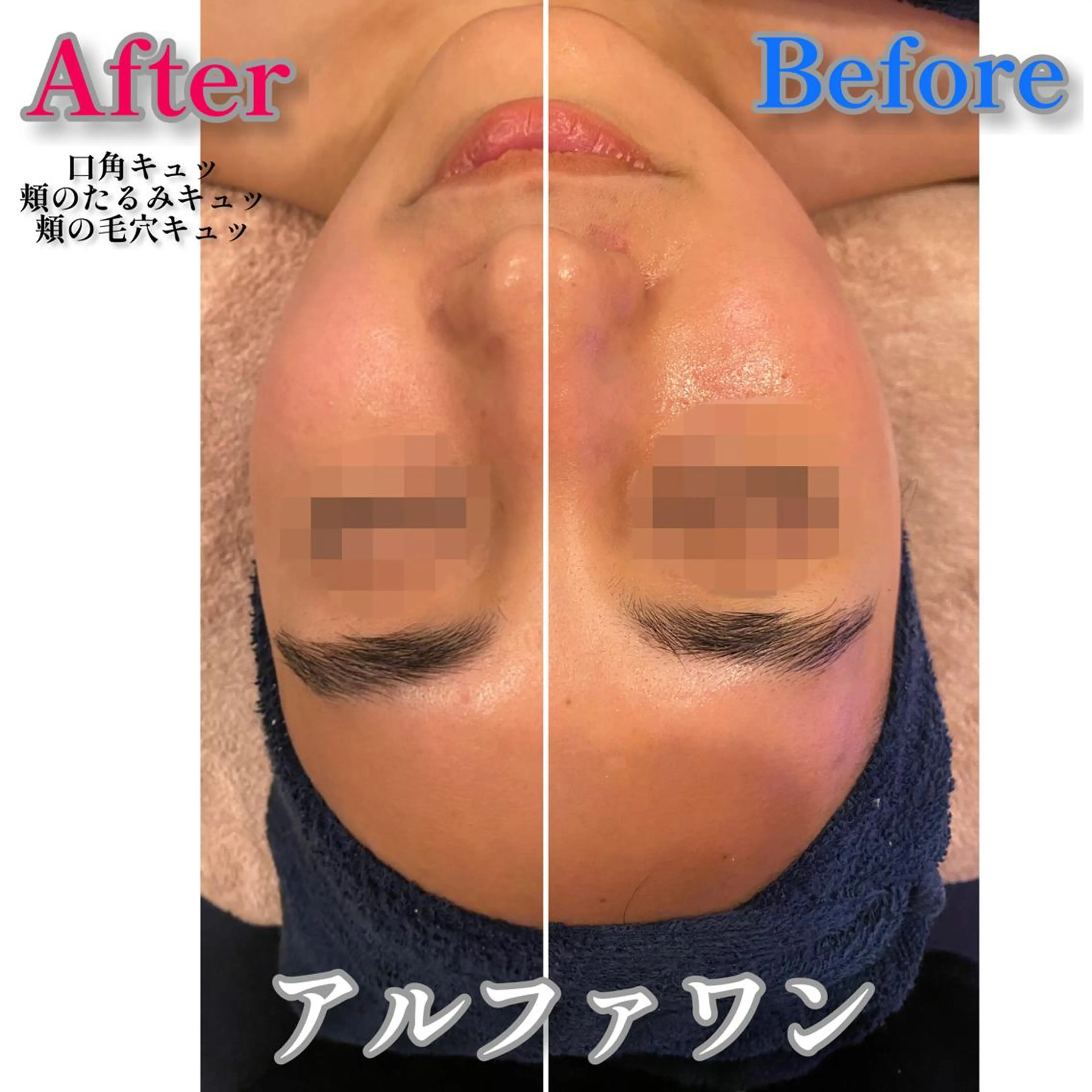 TEIKOKU所属・トータルビューティー TEIKOKUのエステ・リラクイメージ