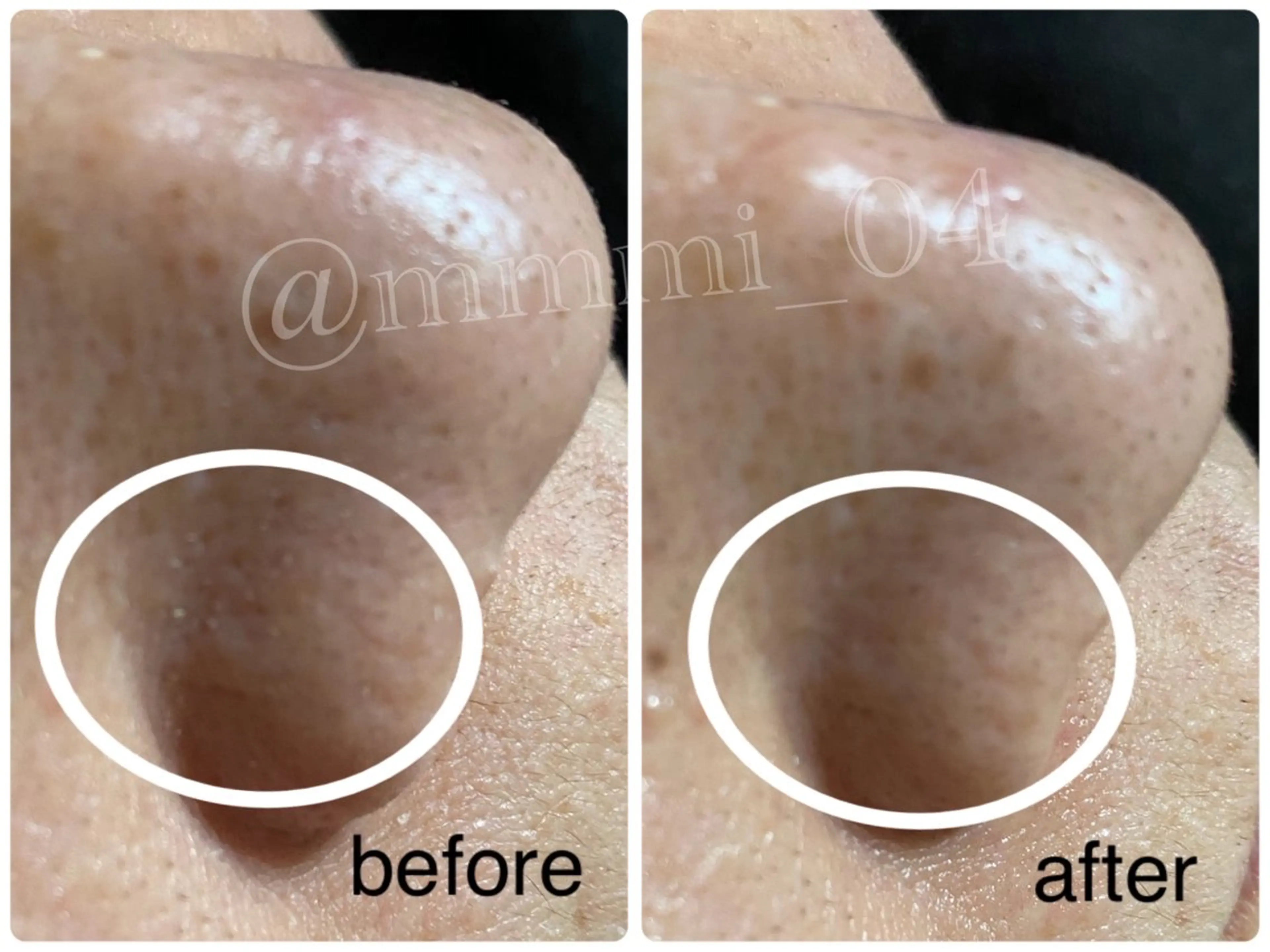 デ・アイム新潟北所属・サイトウ .のエステ・リラクイメージ