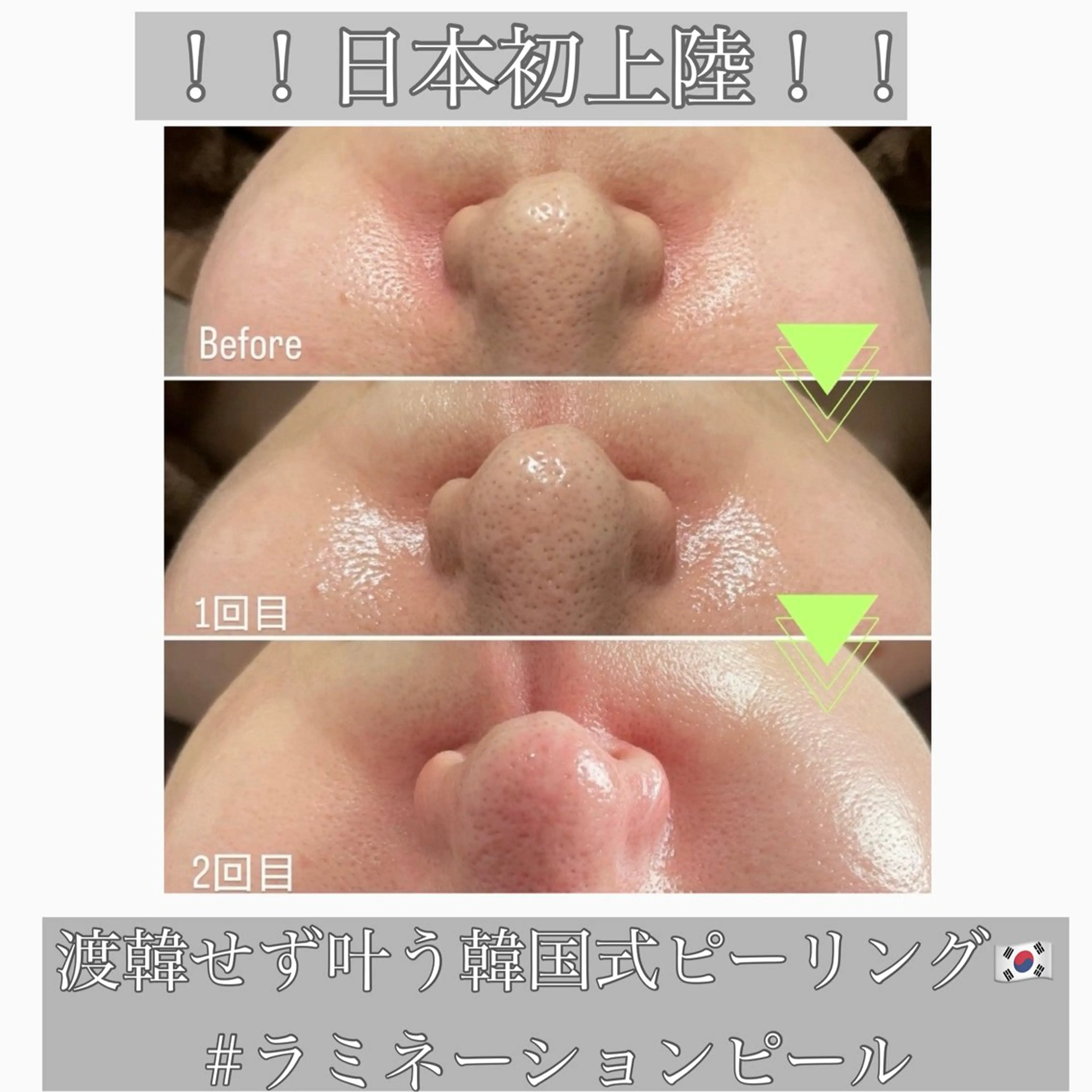 エステ beautysalon RAVIS所属・東大阪/韓国肌管理/ 痩身バスト専門店のエステ・リラクイメージ