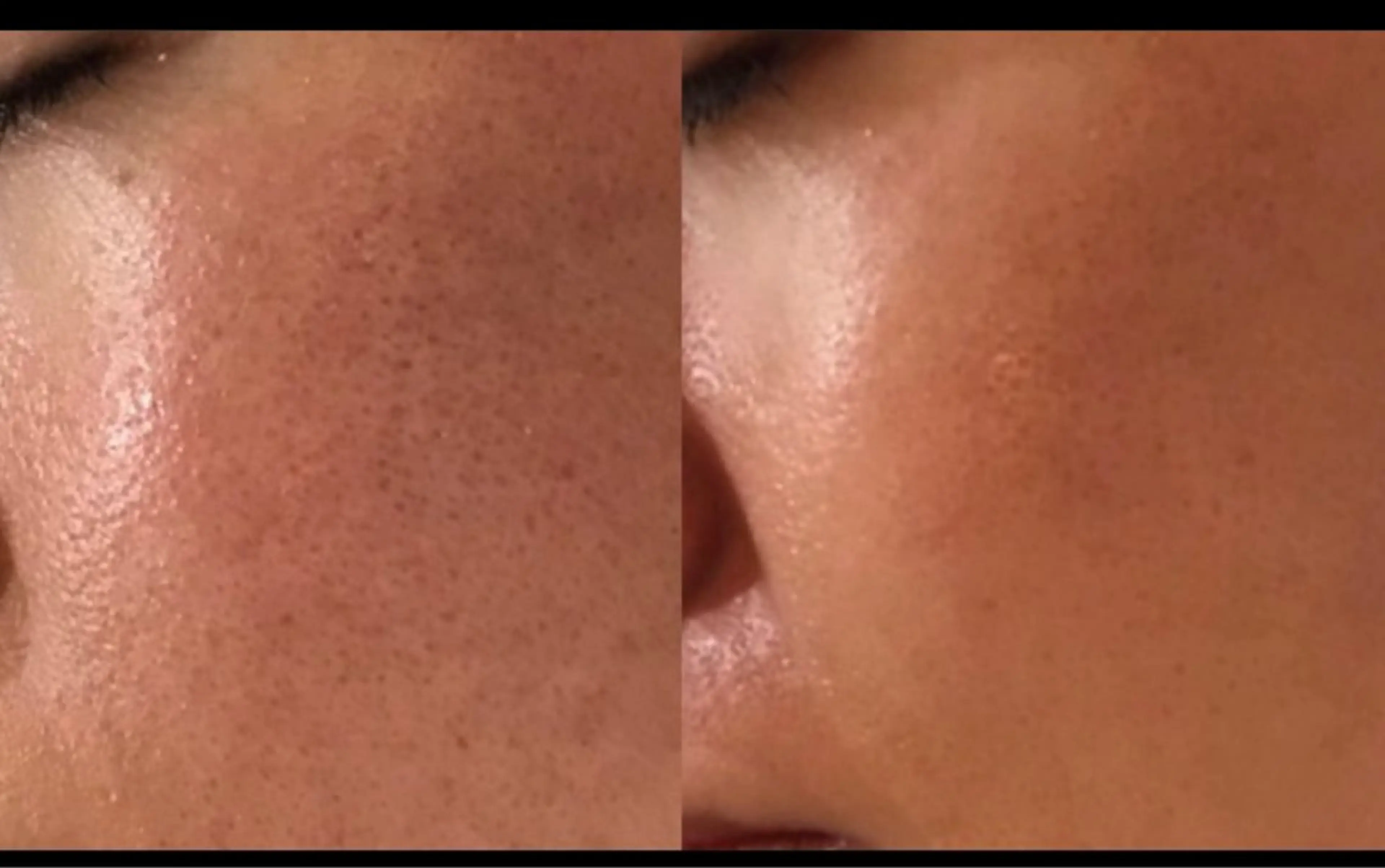 医療提携/ニキビ毛穴 サロンドエクラ南堀江のエステ・リラクイメージ